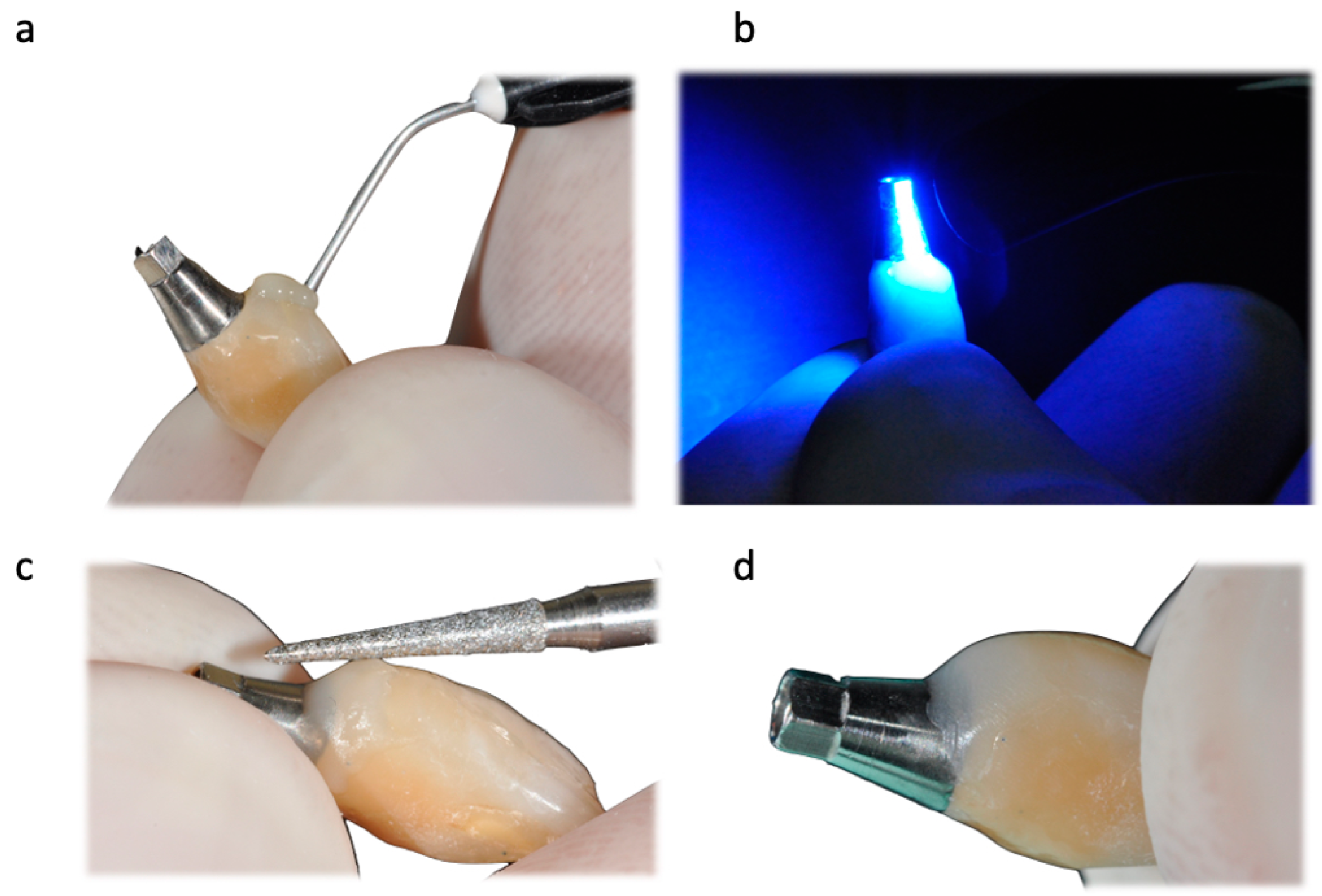 Prosthesis 05 00081 g011