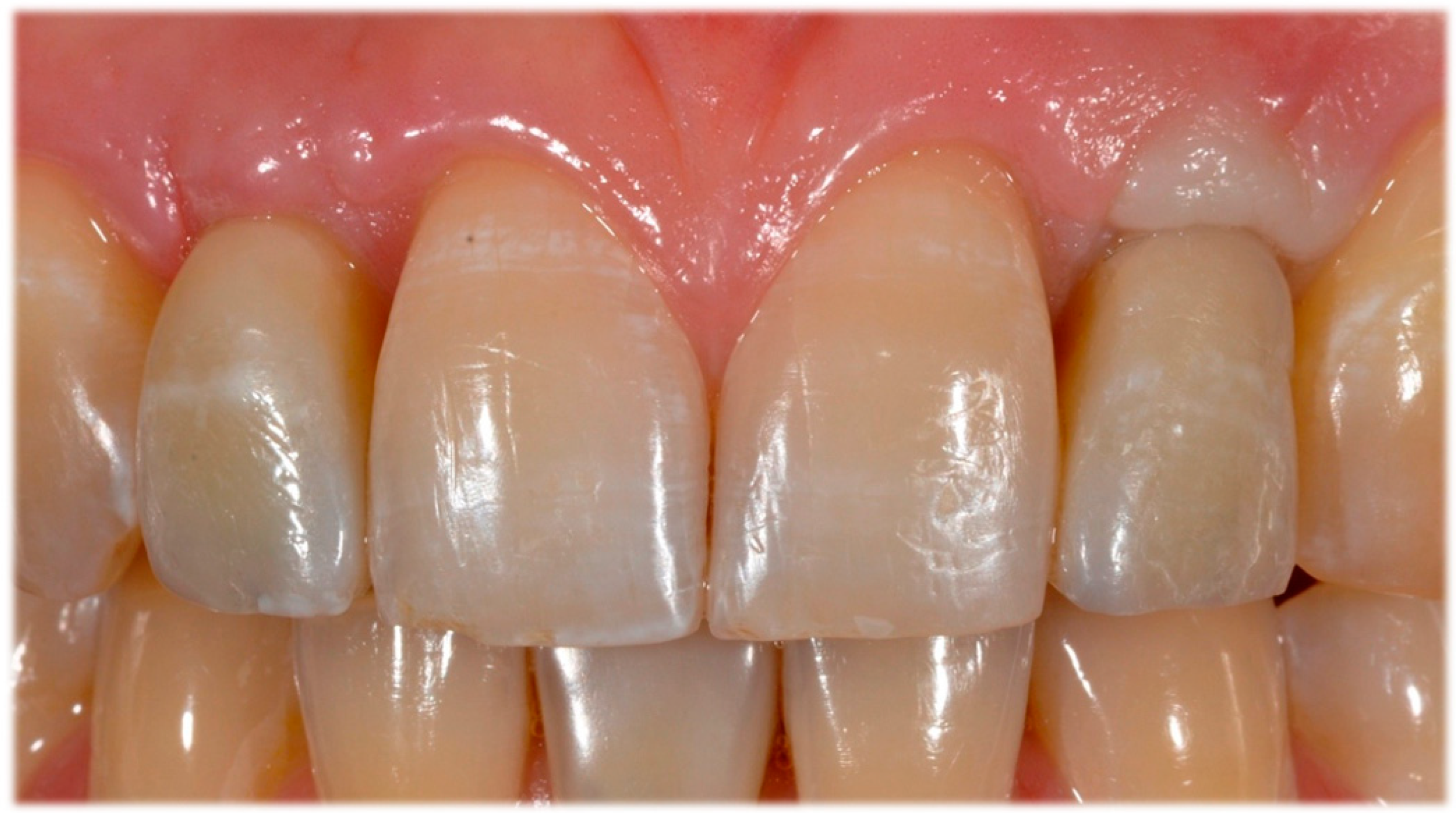 Prosthesis 05 00081 g012