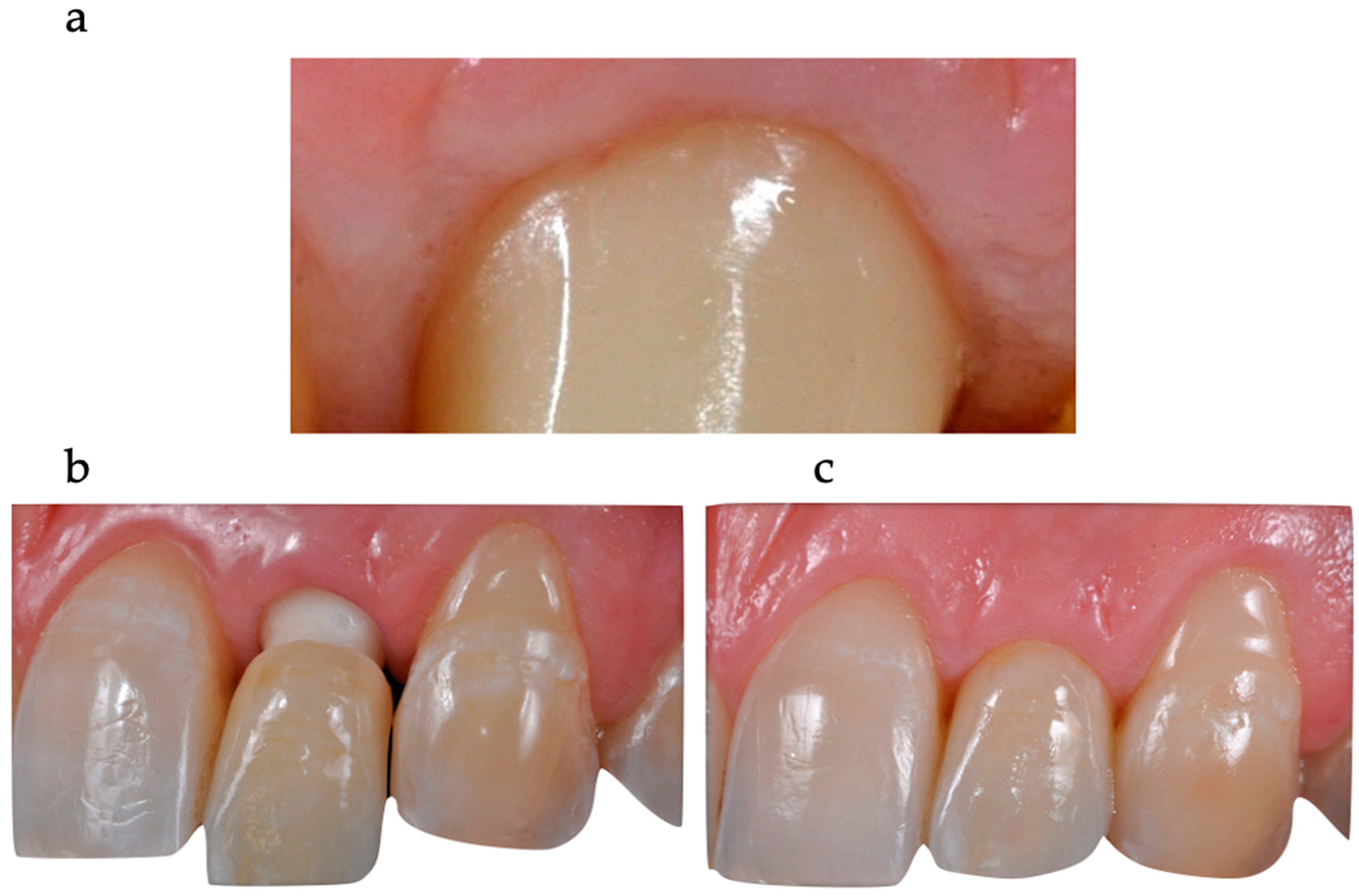 Prosthesis 05 00081 g017