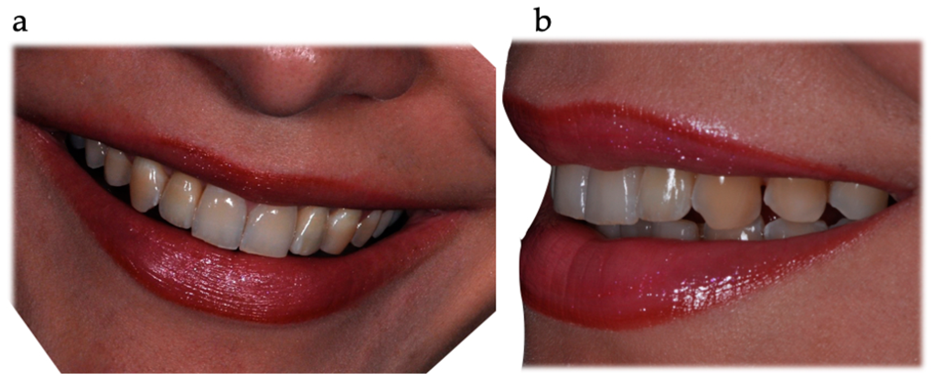 Prosthesis 05 00081 g020