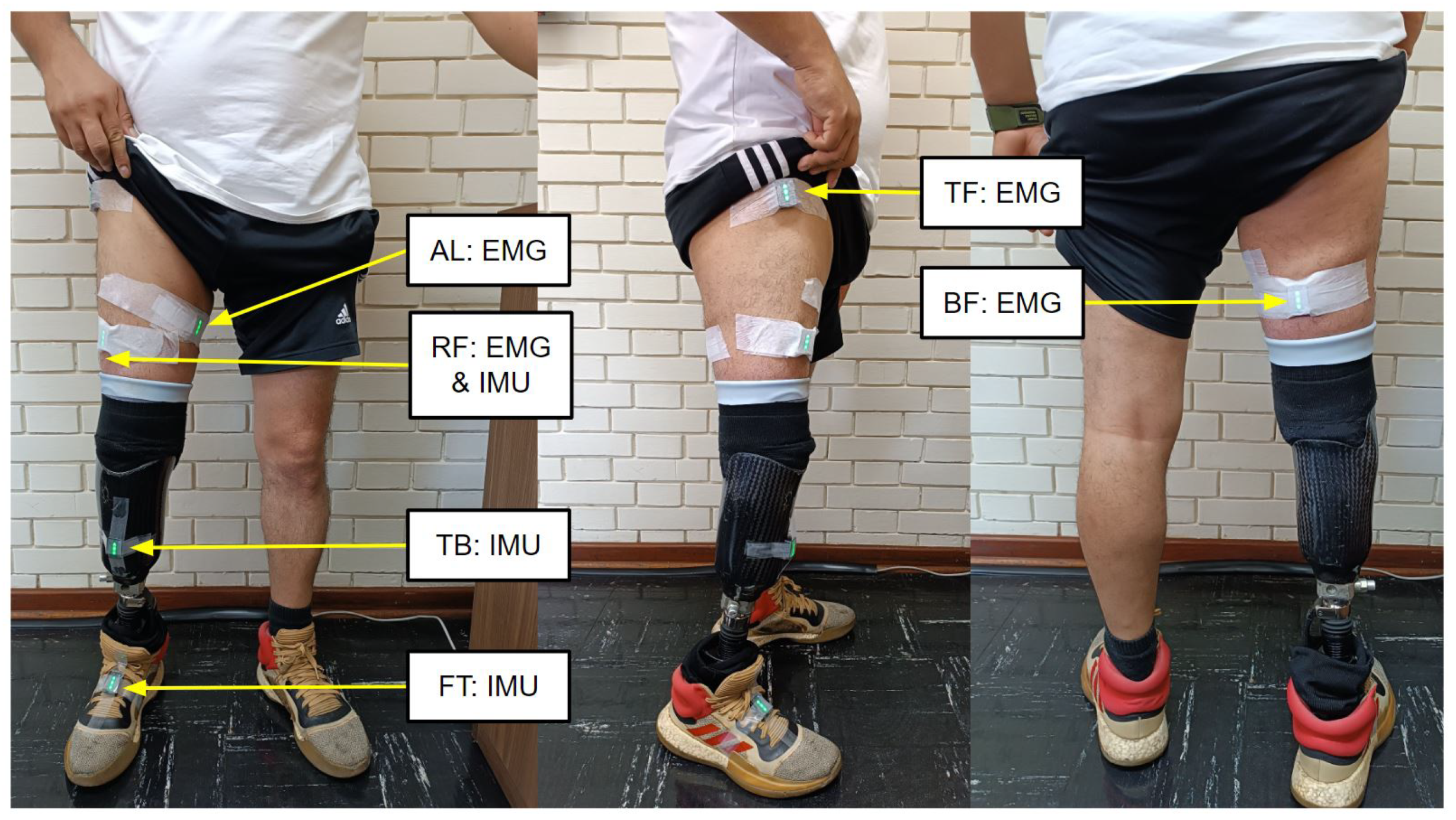 Prosthesis 05 00085 g001