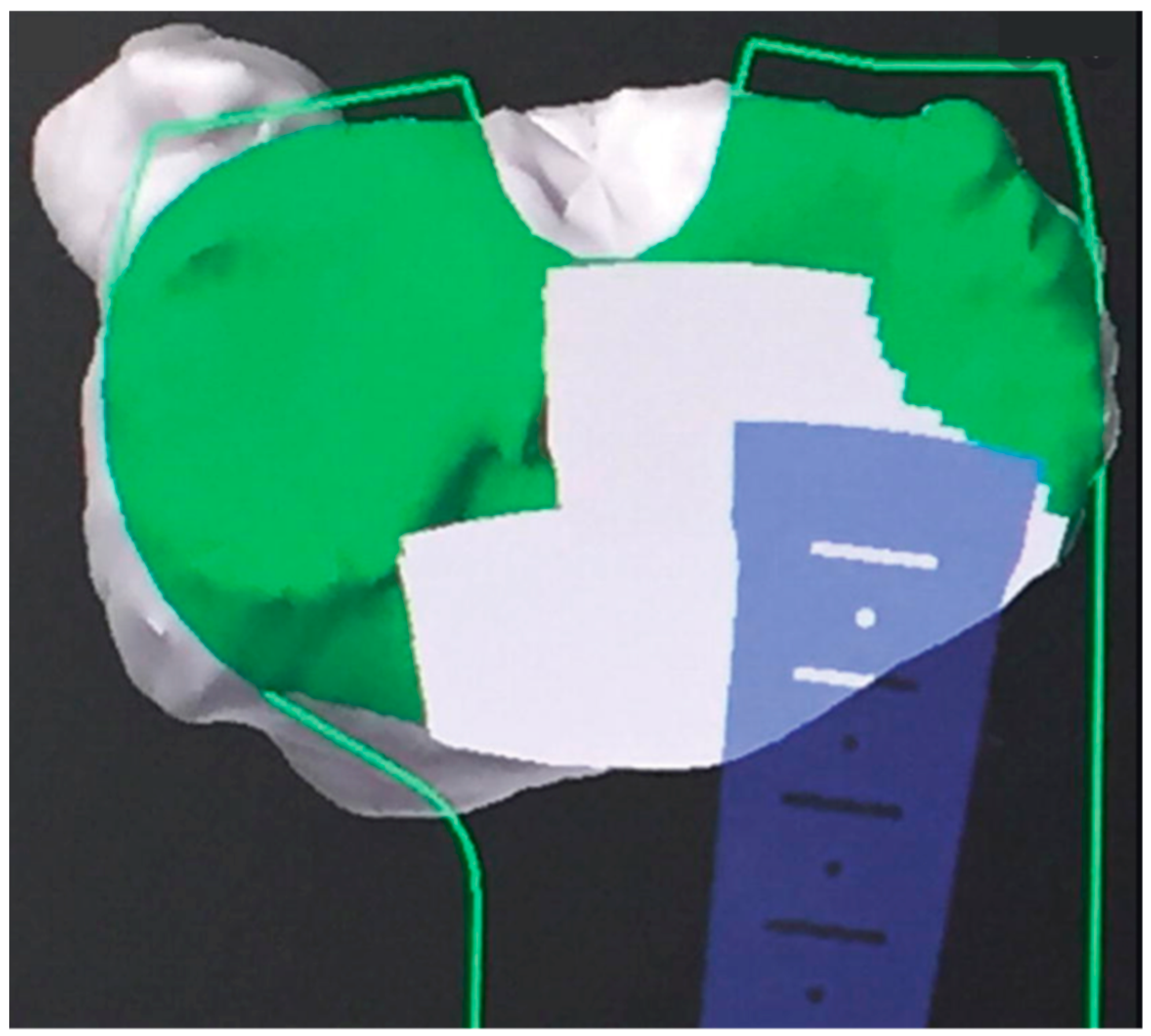 Prosthesis 05 00086 g002 Prosthesis 05 00086 g002