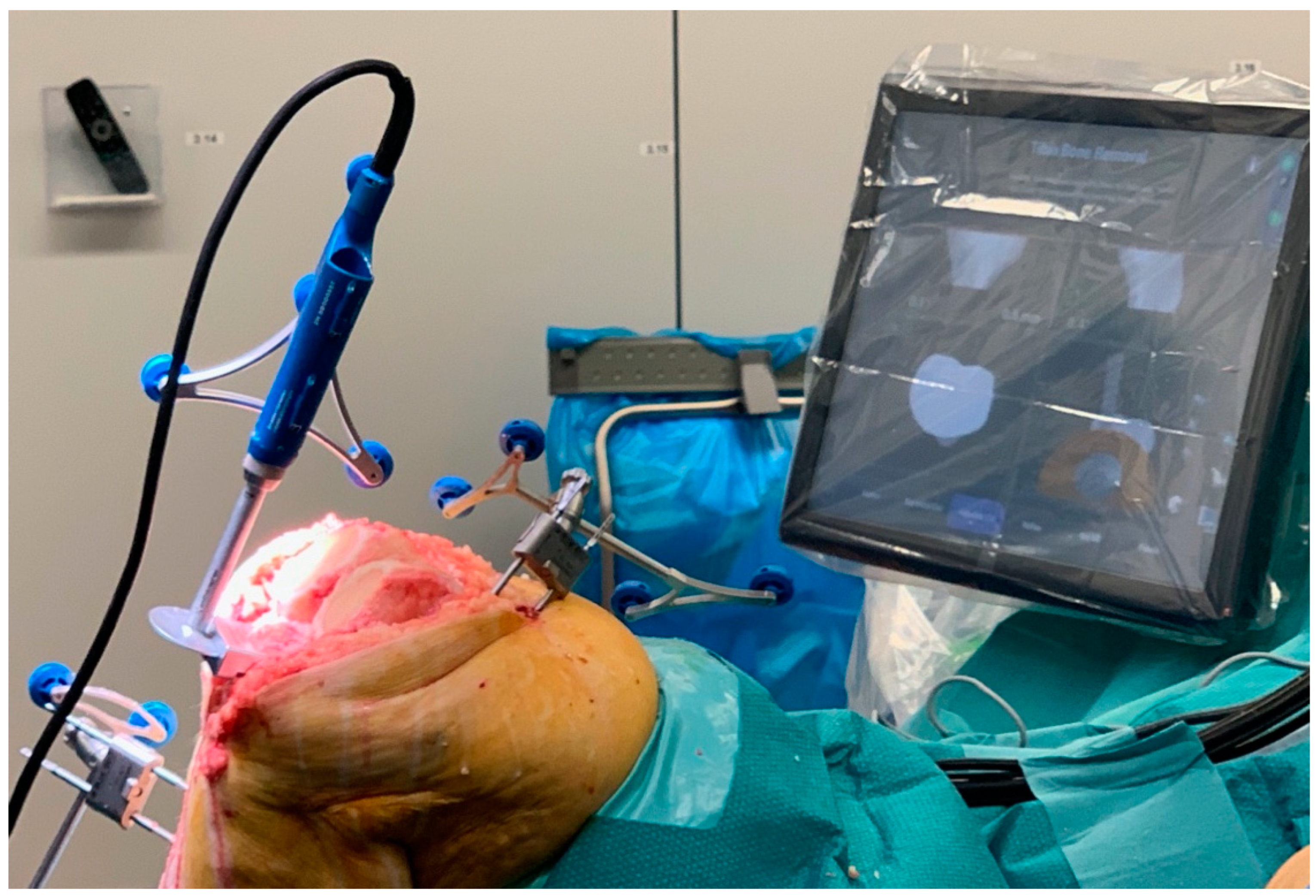 Prosthesis 05 00086 g004 Prosthesis 05 00086 g004