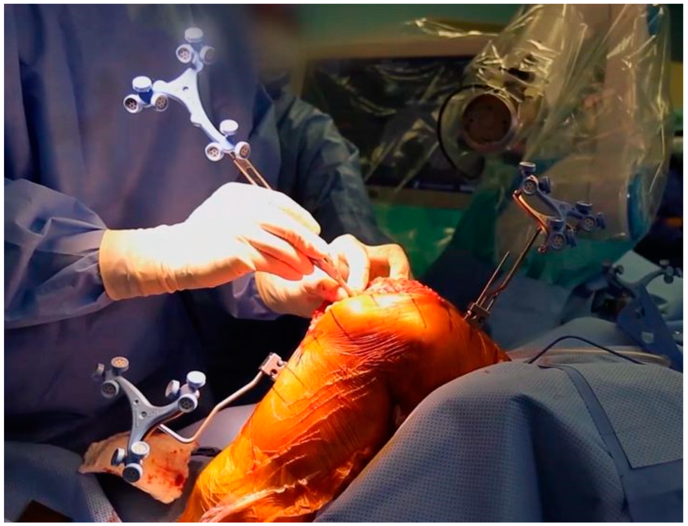 Prosthesis 05 00086 g006 Prosthesis 05 00086 g006