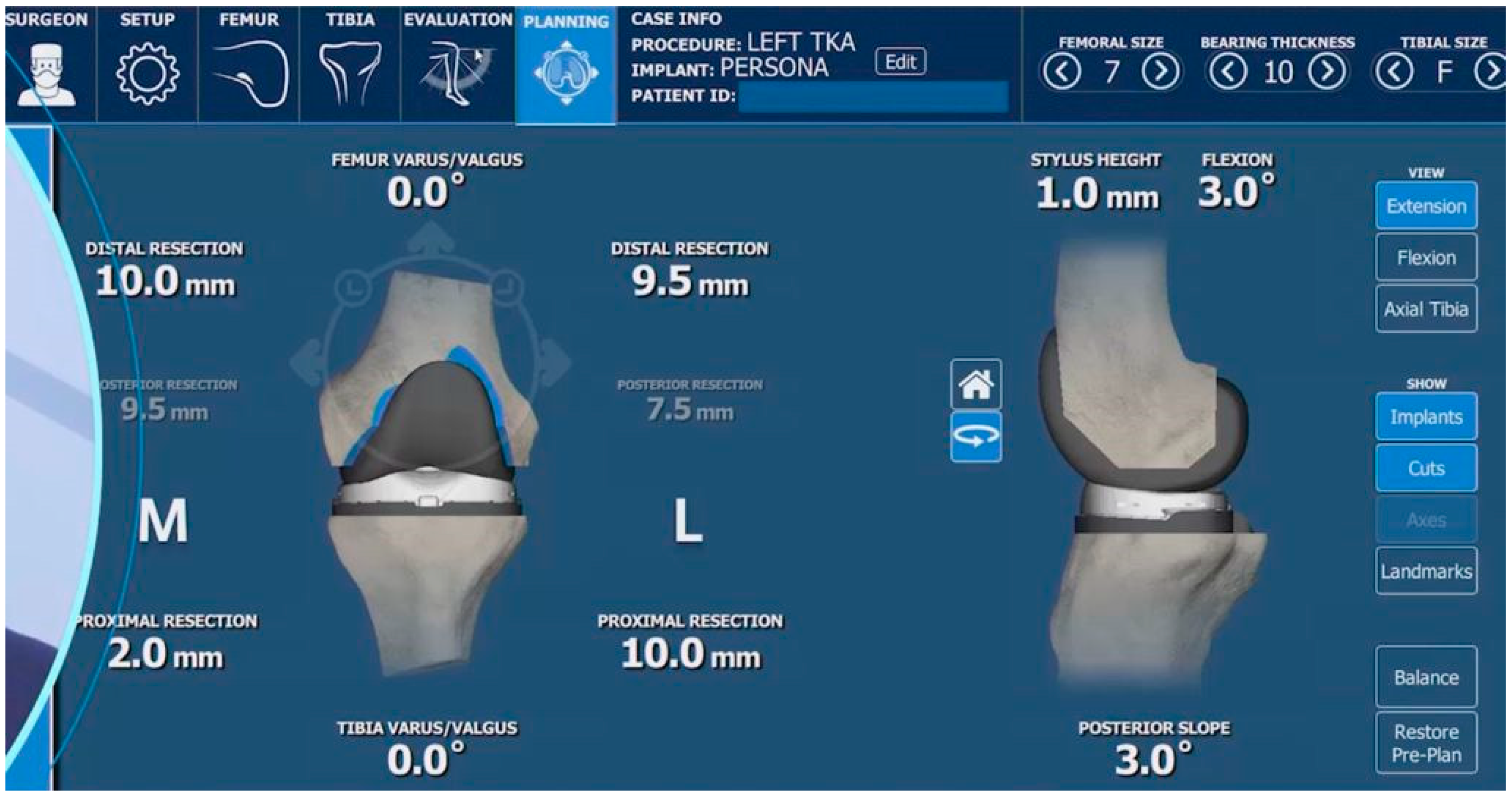 Prosthesis 05 00086 g007 Prosthesis 05 00086 g007