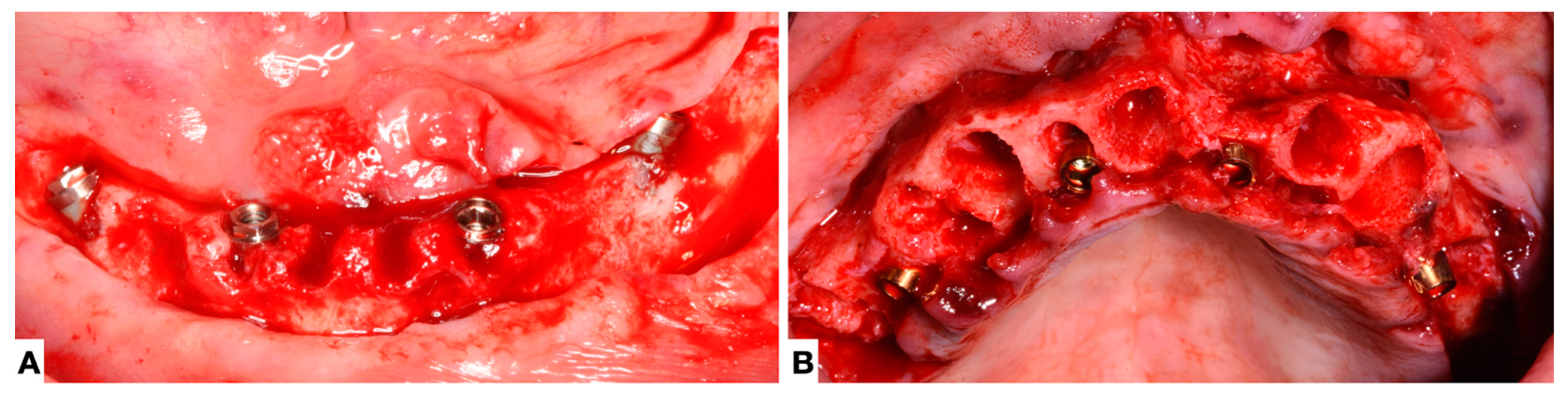Prosthesis 05 00089 g001