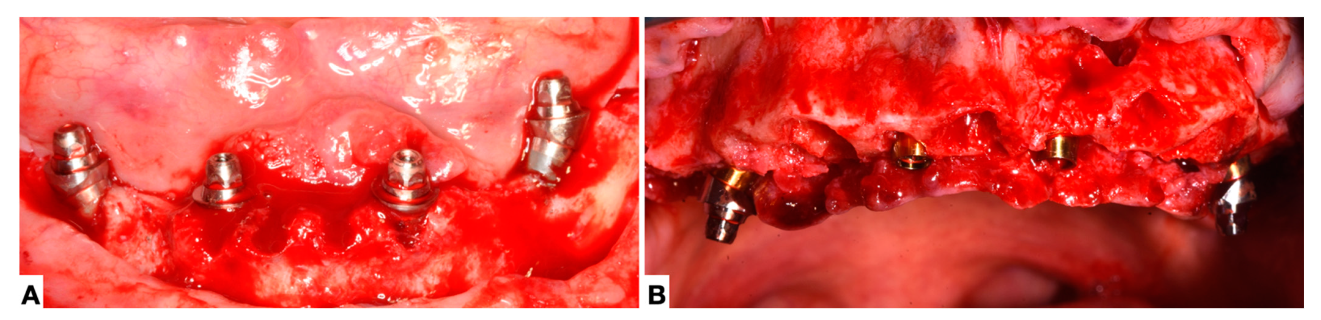 Prosthesis 05 00089 g002