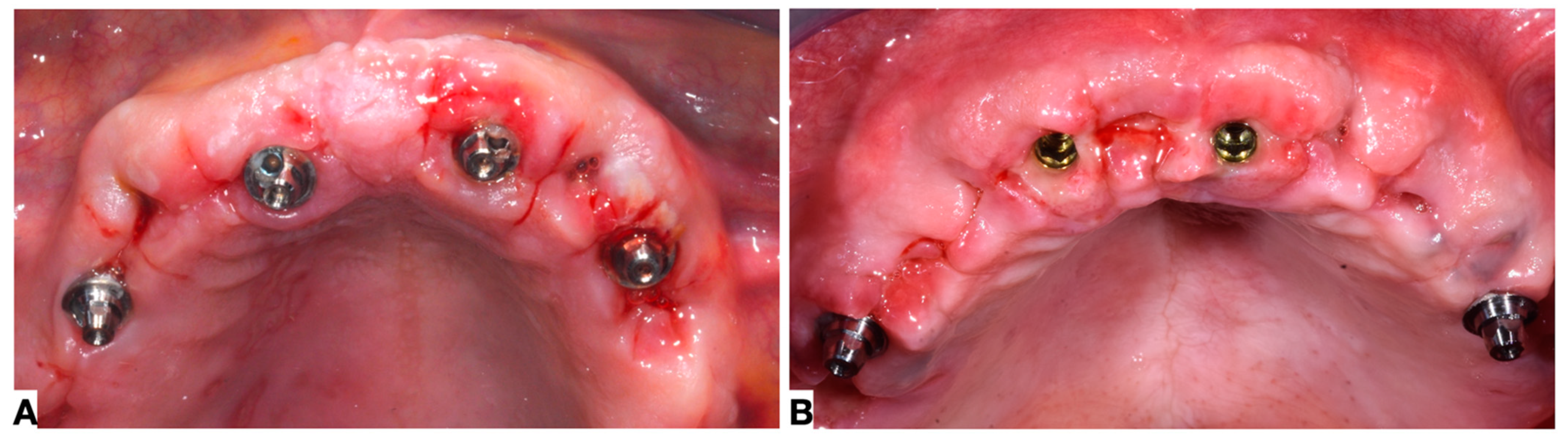 Prosthesis 05 00089 g003
