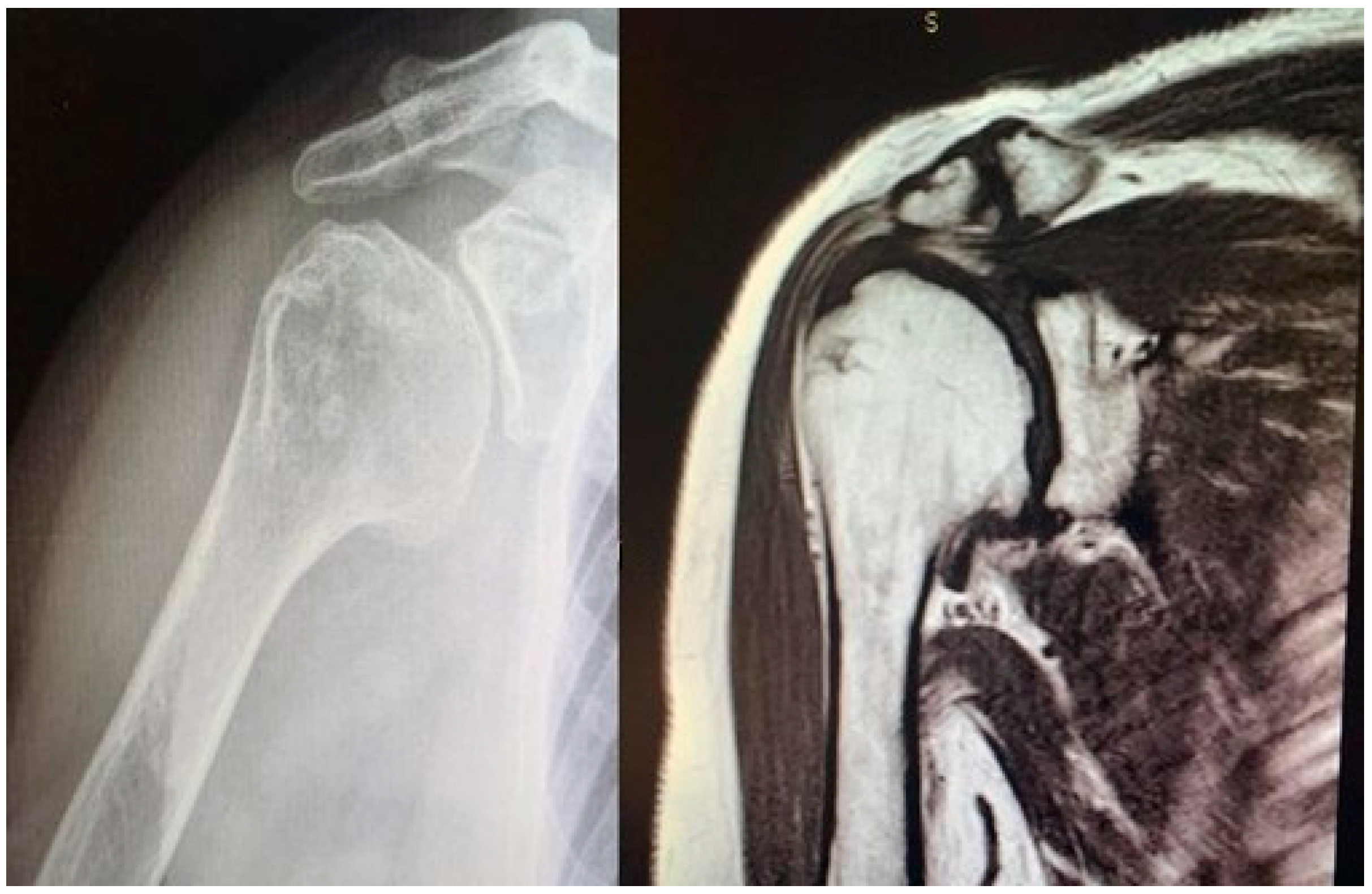 Prosthesis 05 00090 g001