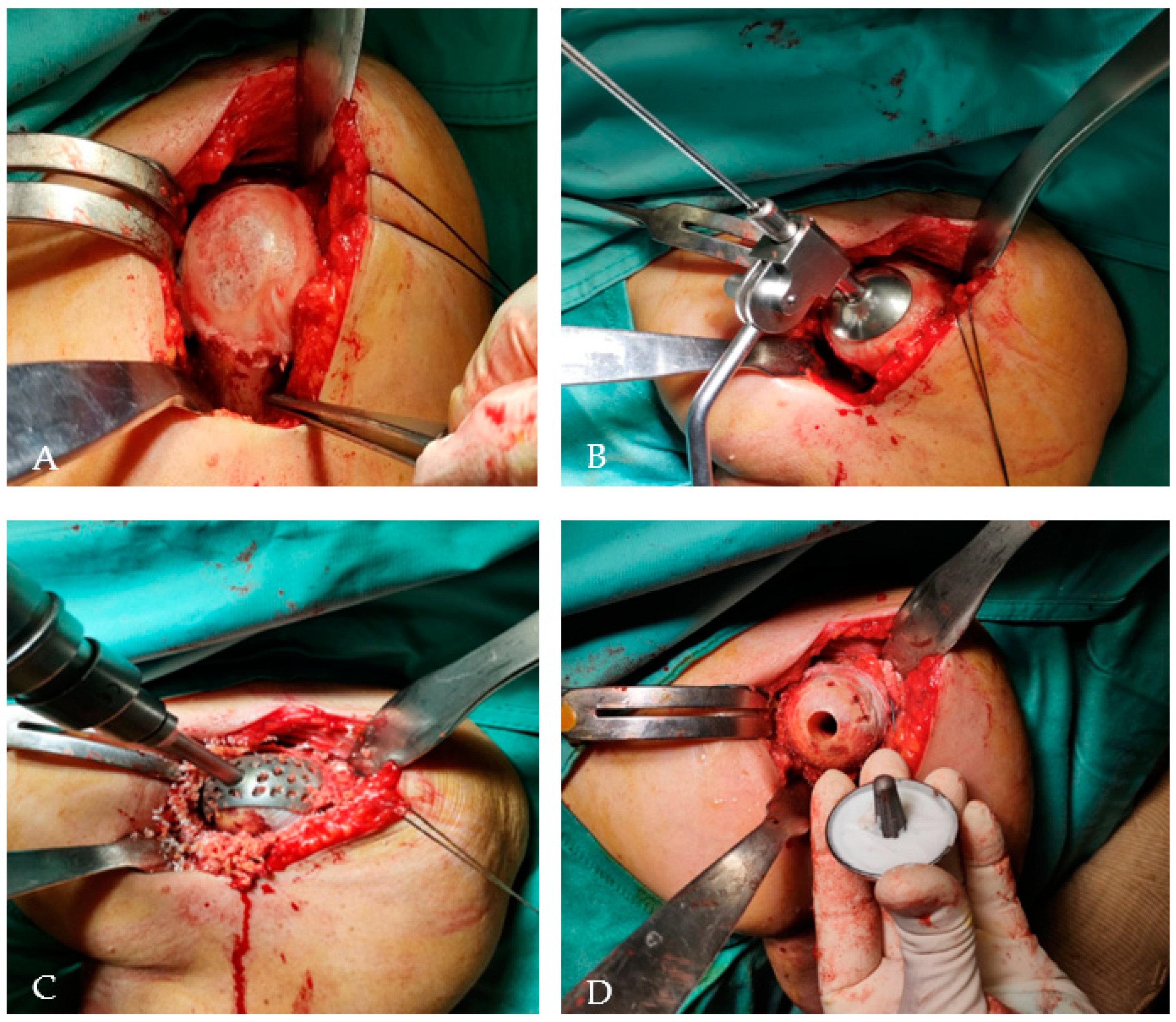 Prosthesis 05 00090 g004