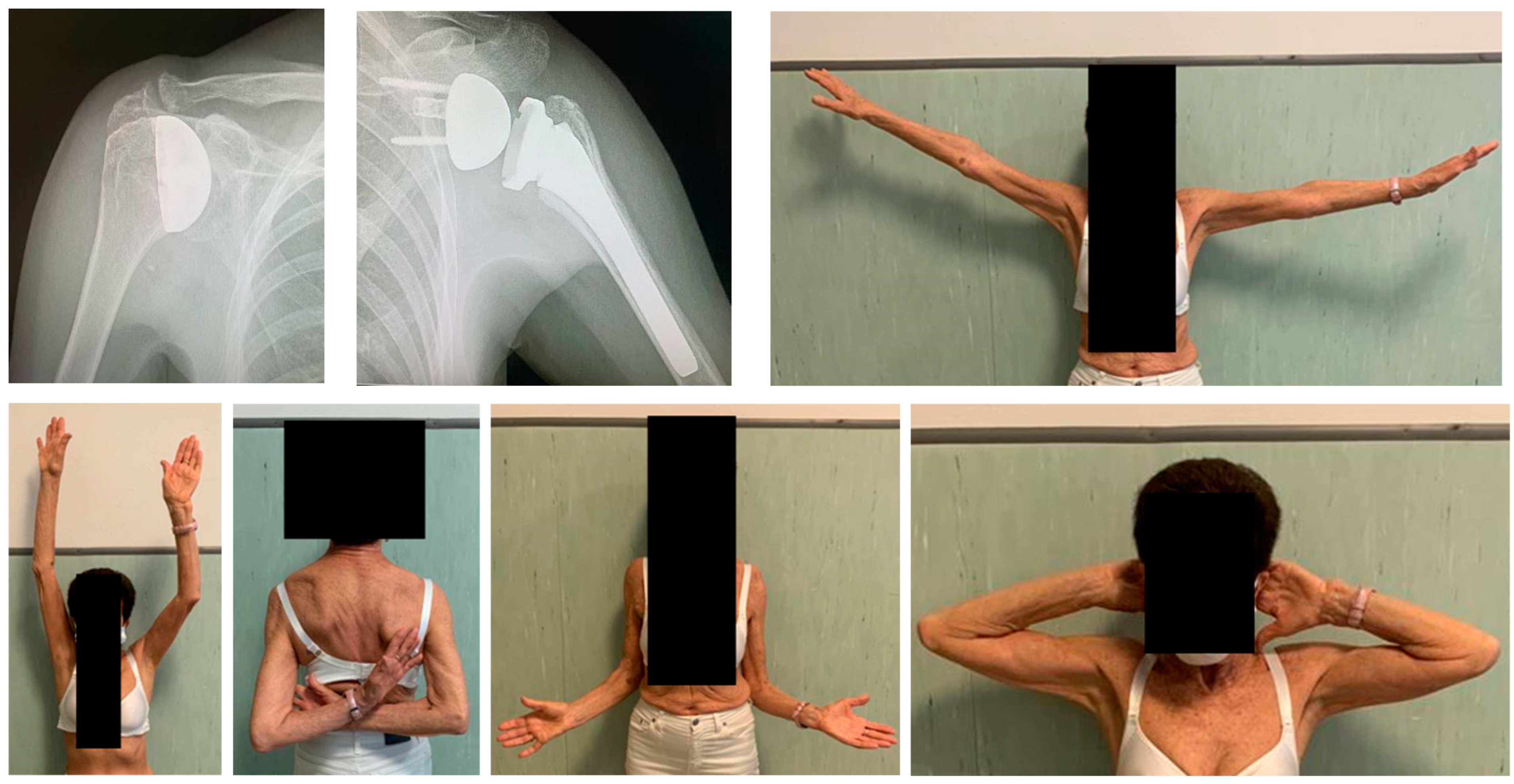 Prosthesis 05 00090 g005