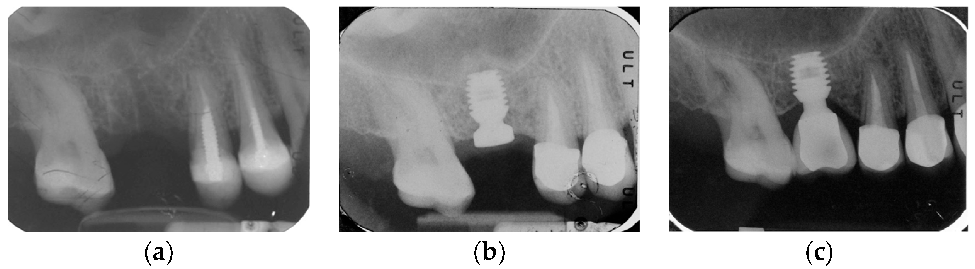 Prosthesis 05 00091 g002 Prosthesis 05 00091 g002