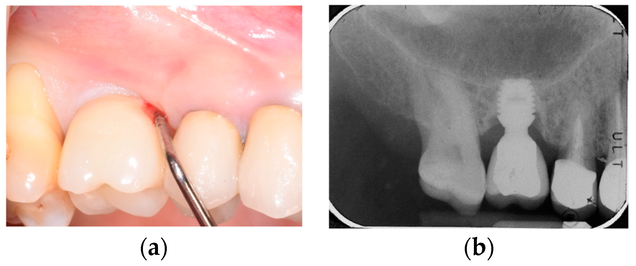 Prosthesis 05 00091 g003 Prosthesis 05 00091 g003