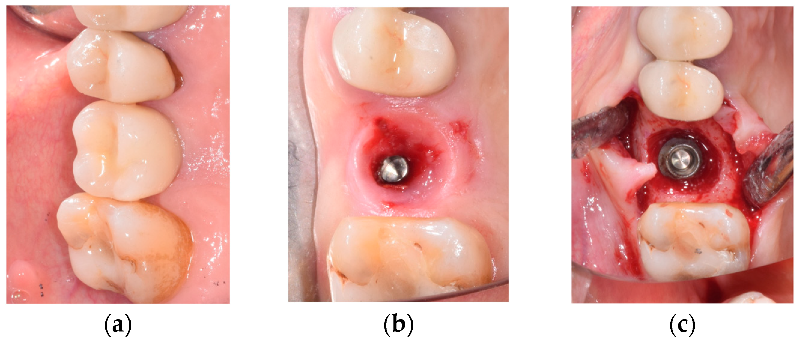 Prosthesis 05 00091 g004 Prosthesis 05 00091 g004