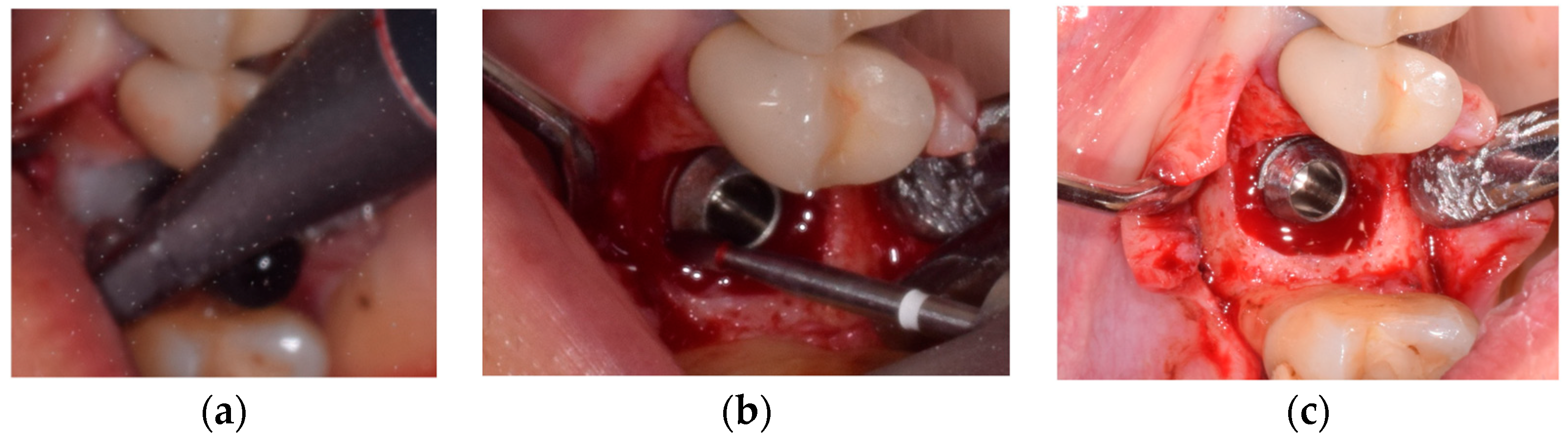 Prosthesis 05 00091 g006 Prosthesis 05 00091 g006