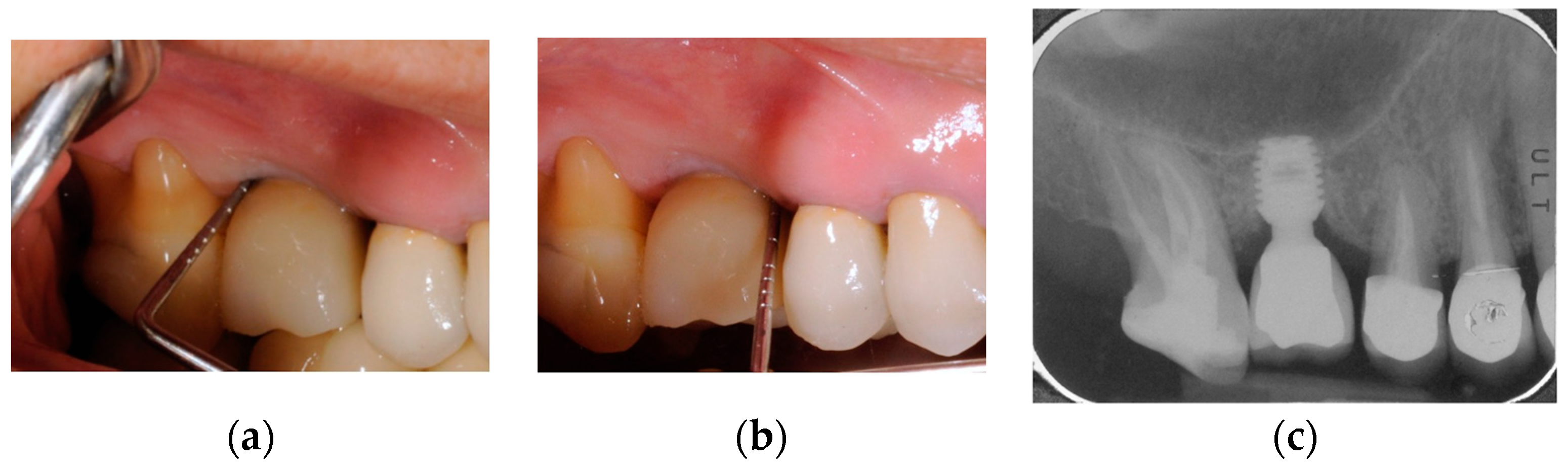 Prosthesis 05 00091 g008 Prosthesis 05 00091 g008