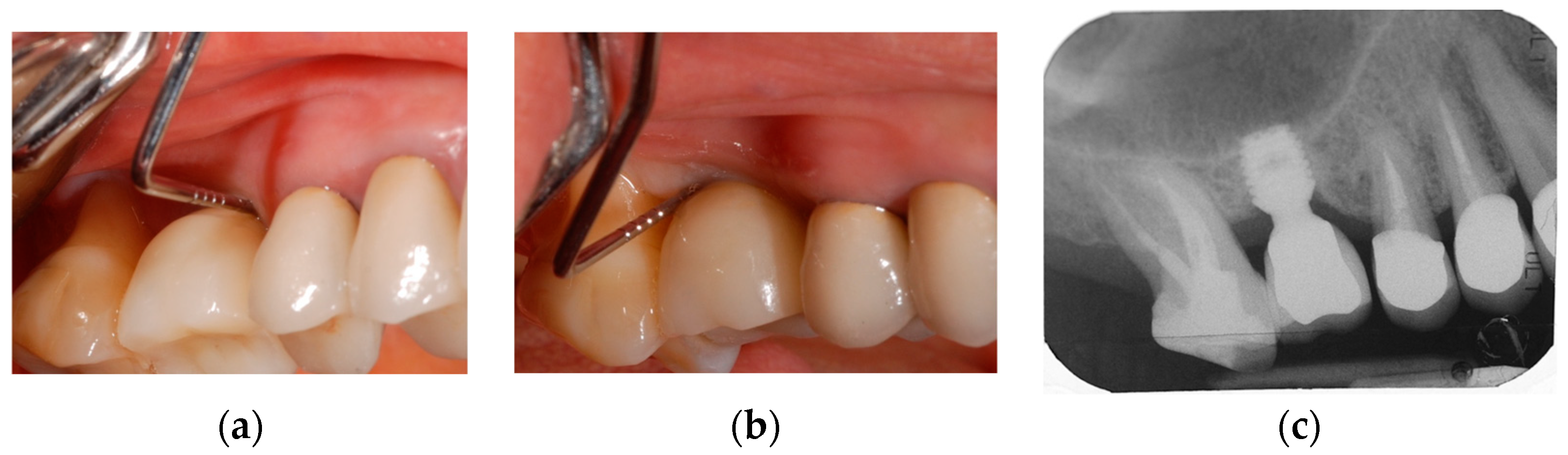 Prosthesis 05 00091 g009 Prosthesis 05 00091 g009