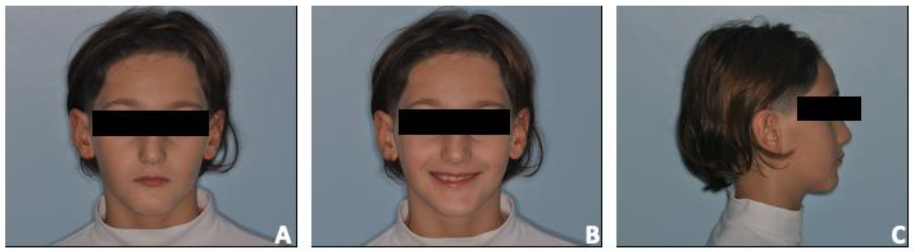 Prosthesis 06 00011 g001