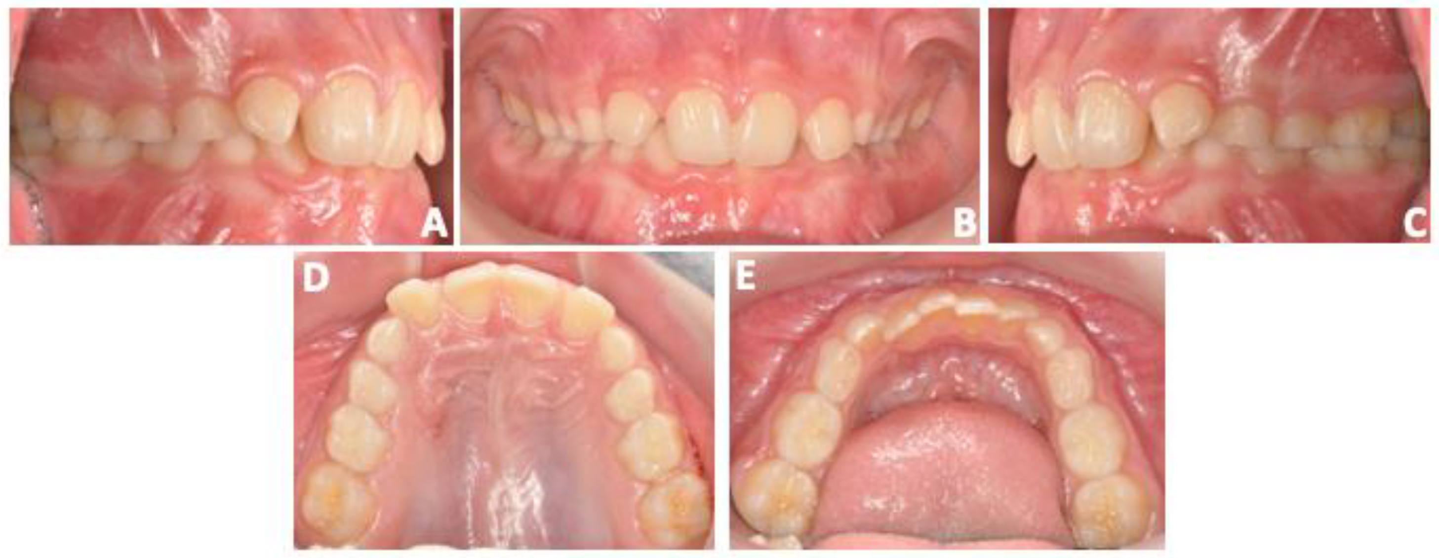 Prosthesis 06 00011 g002