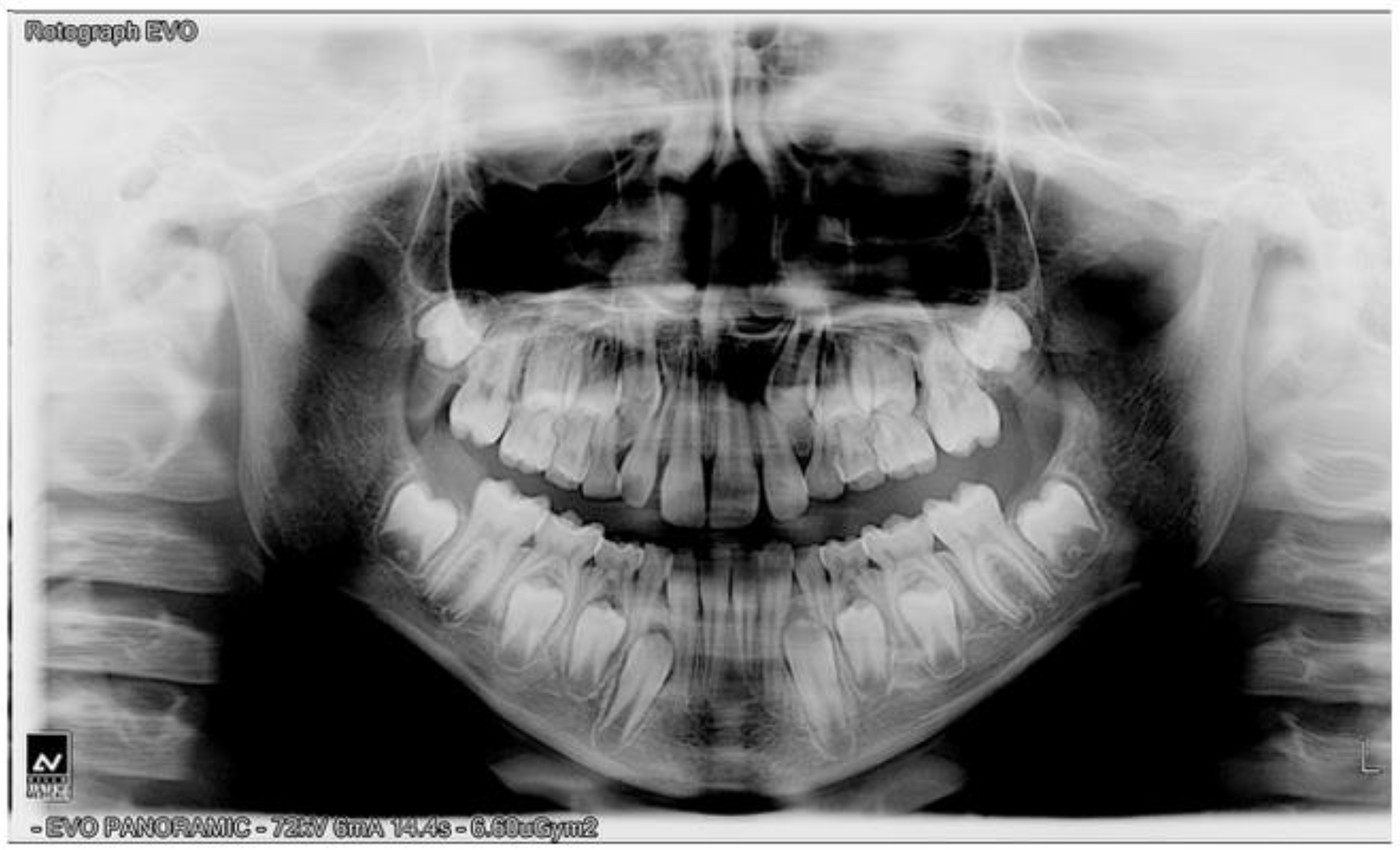 Prosthesis 06 00011 g004