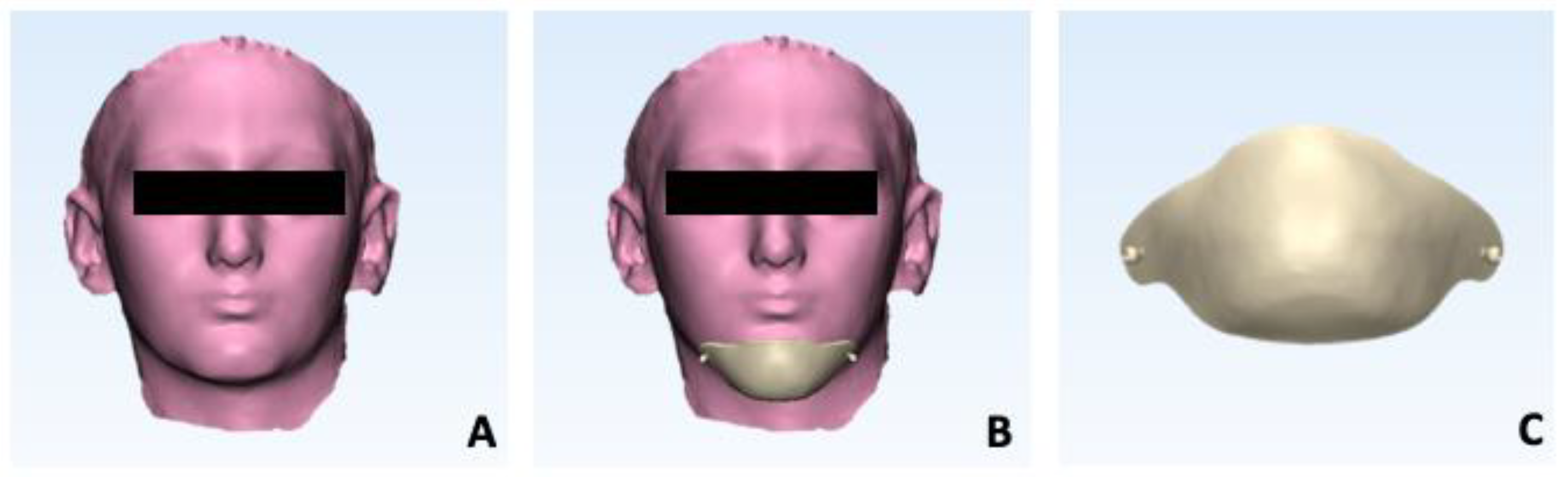 Prosthesis 06 00011 g005