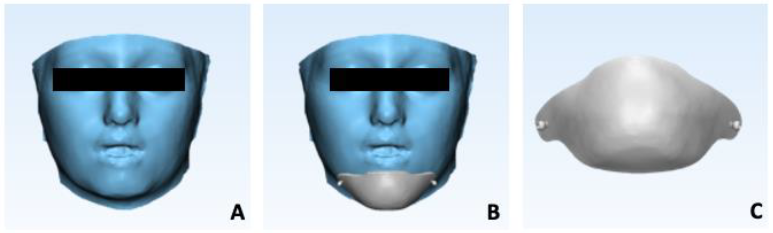 Prosthesis 06 00011 g006