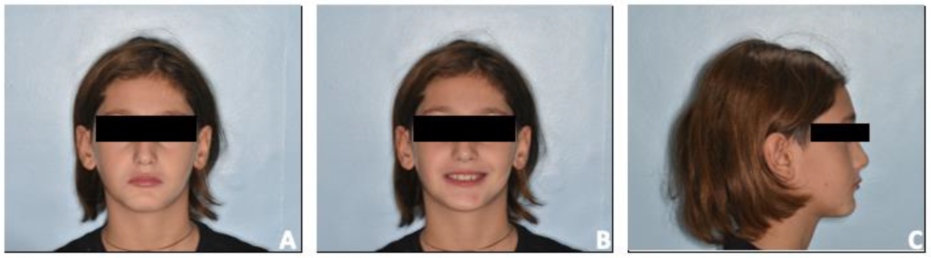 Prosthesis 06 00011 g008