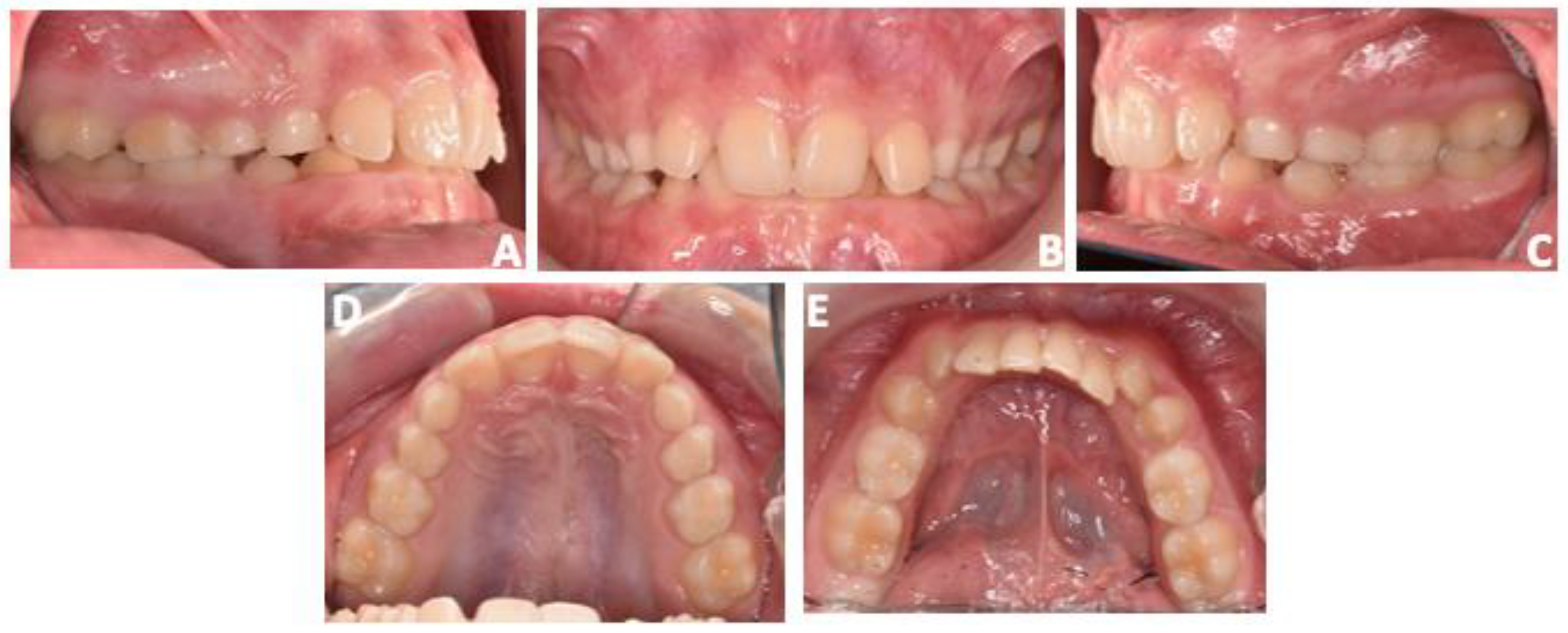 Prosthesis 06 00011 g009