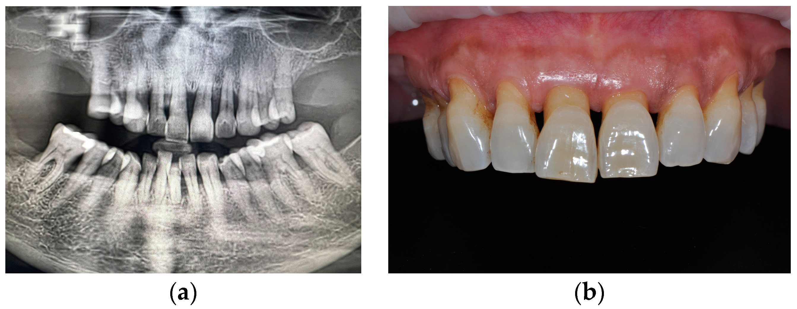 Prosthesis 06 00016 g001