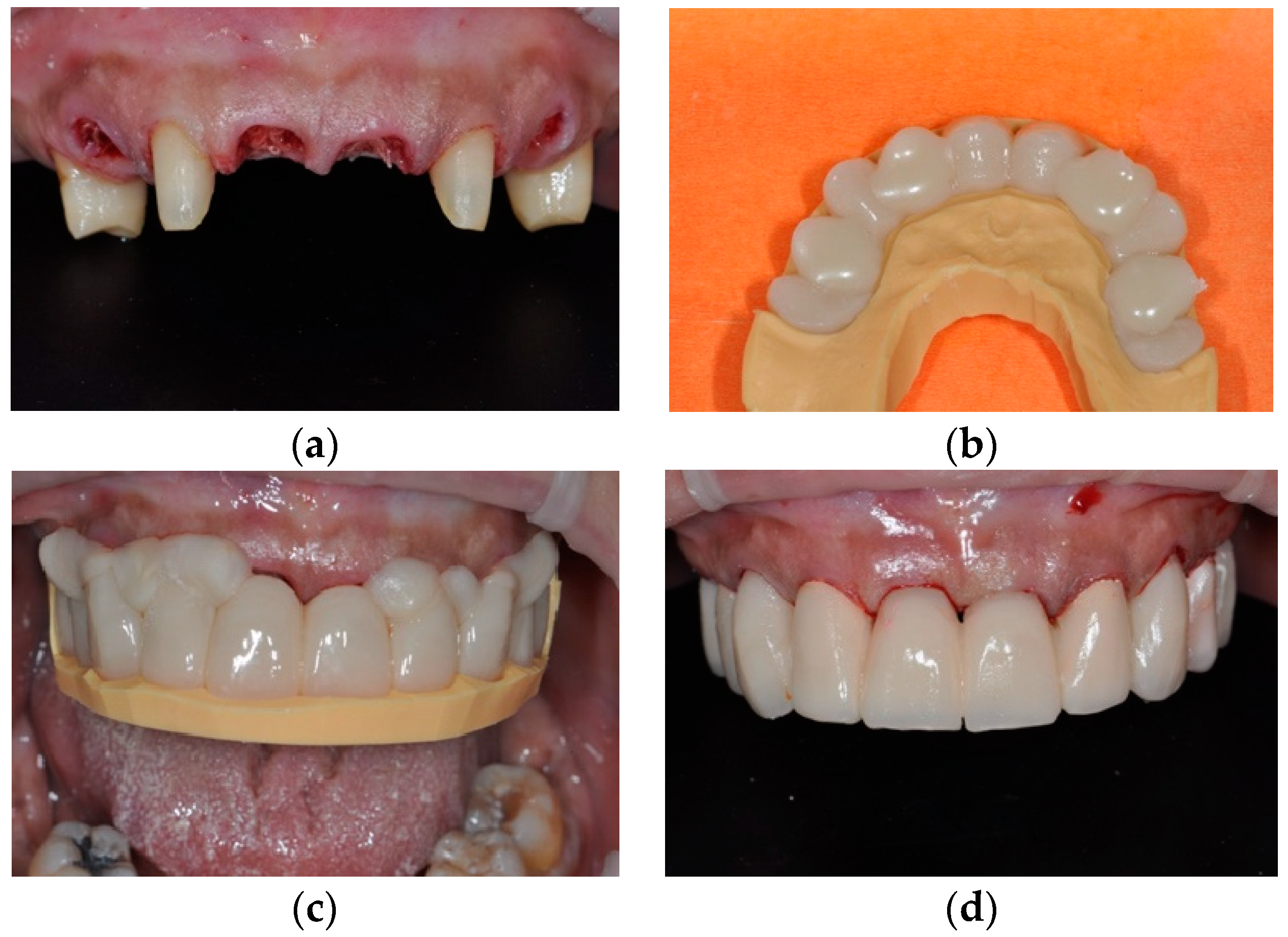 Prosthesis 06 00016 g002