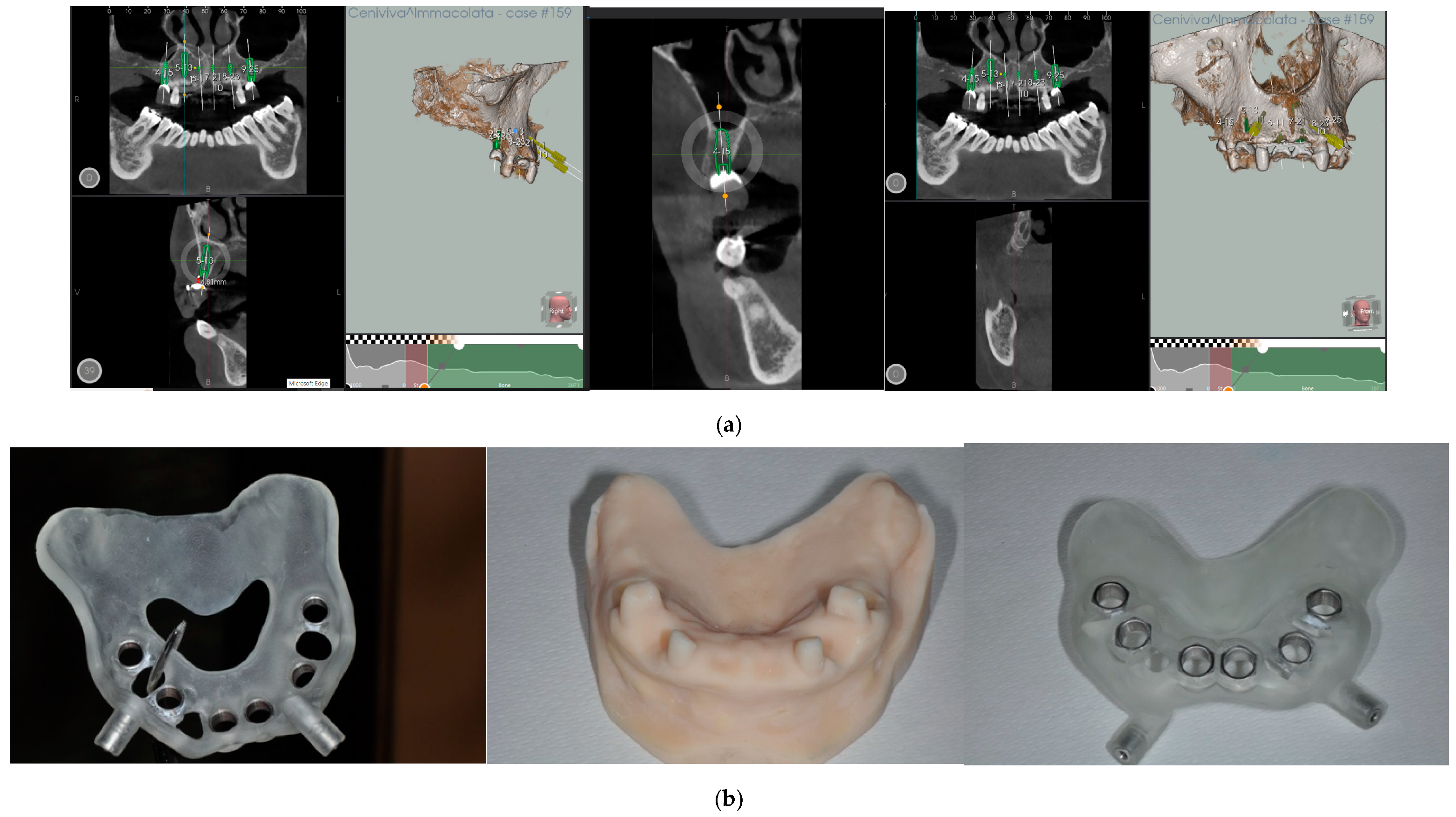 Prosthesis 06 00016 g003