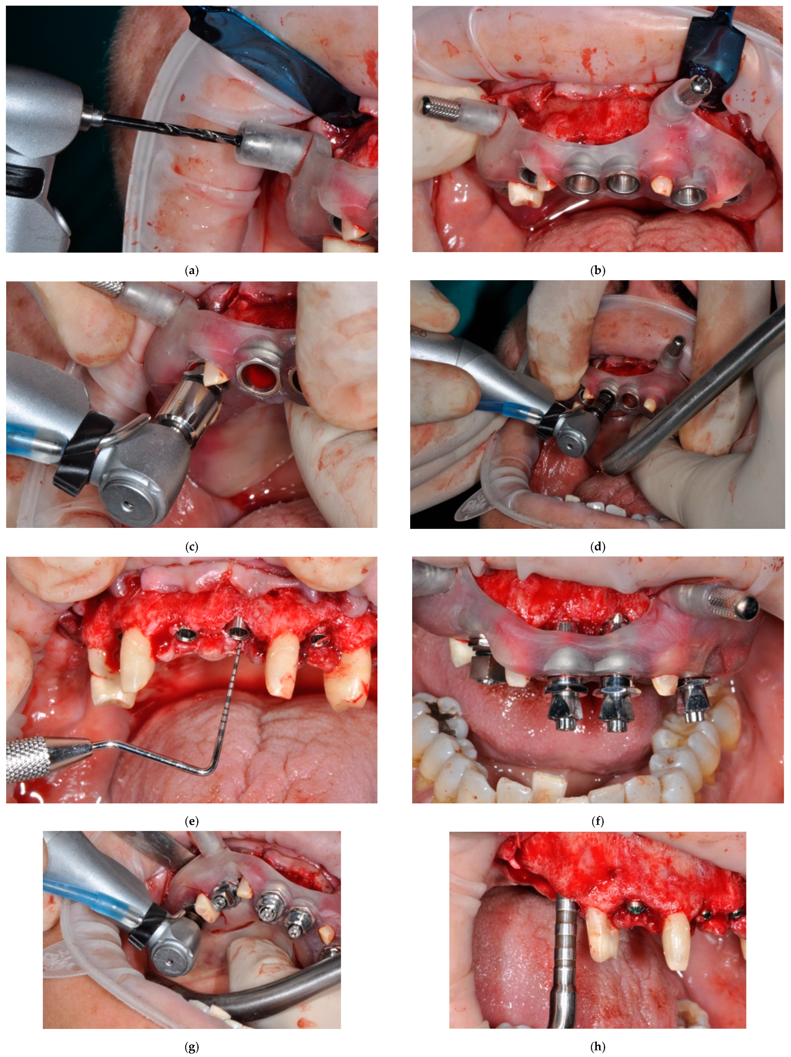 Prosthesis 06 00016 g004a