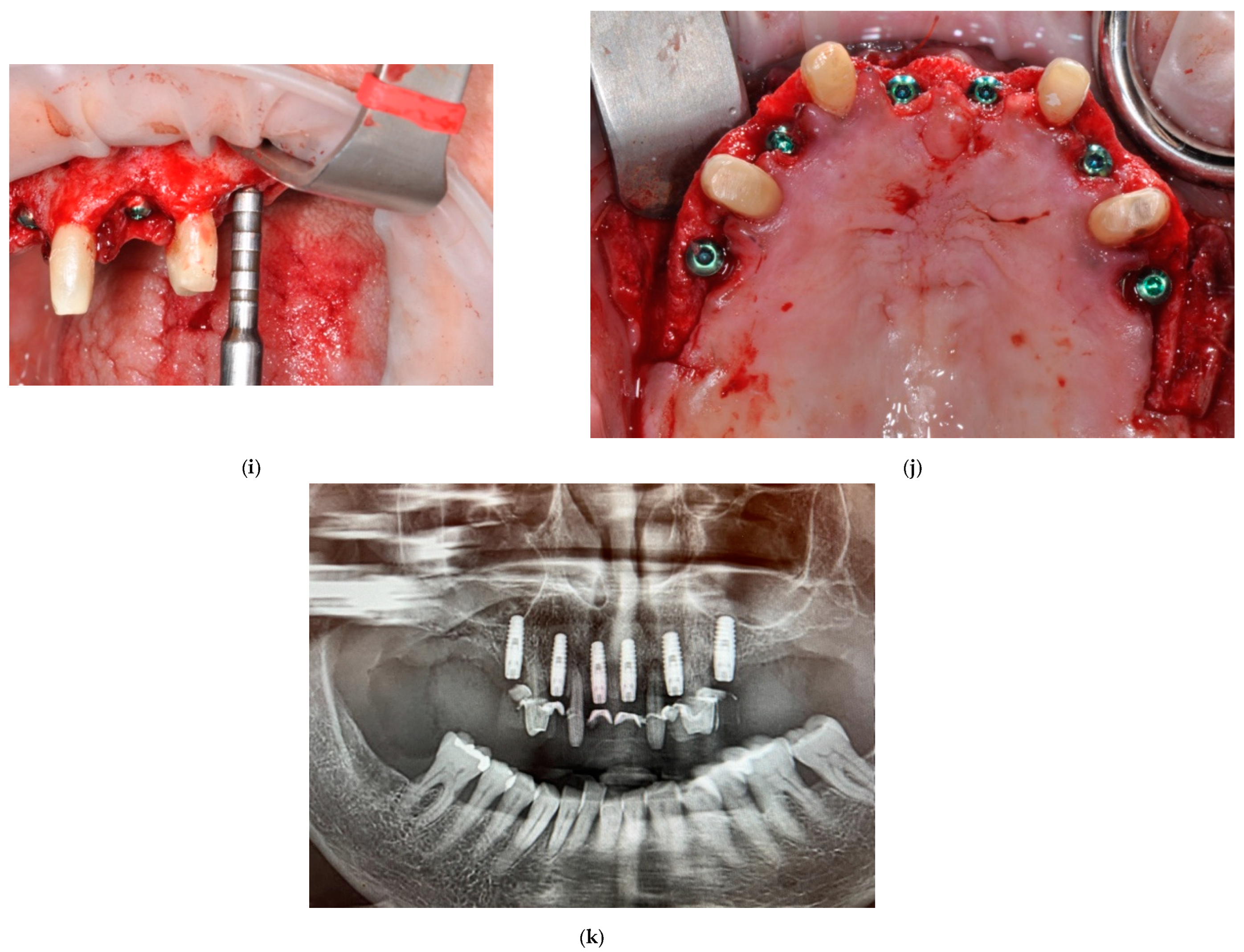 Prosthesis 06 00016 g004b