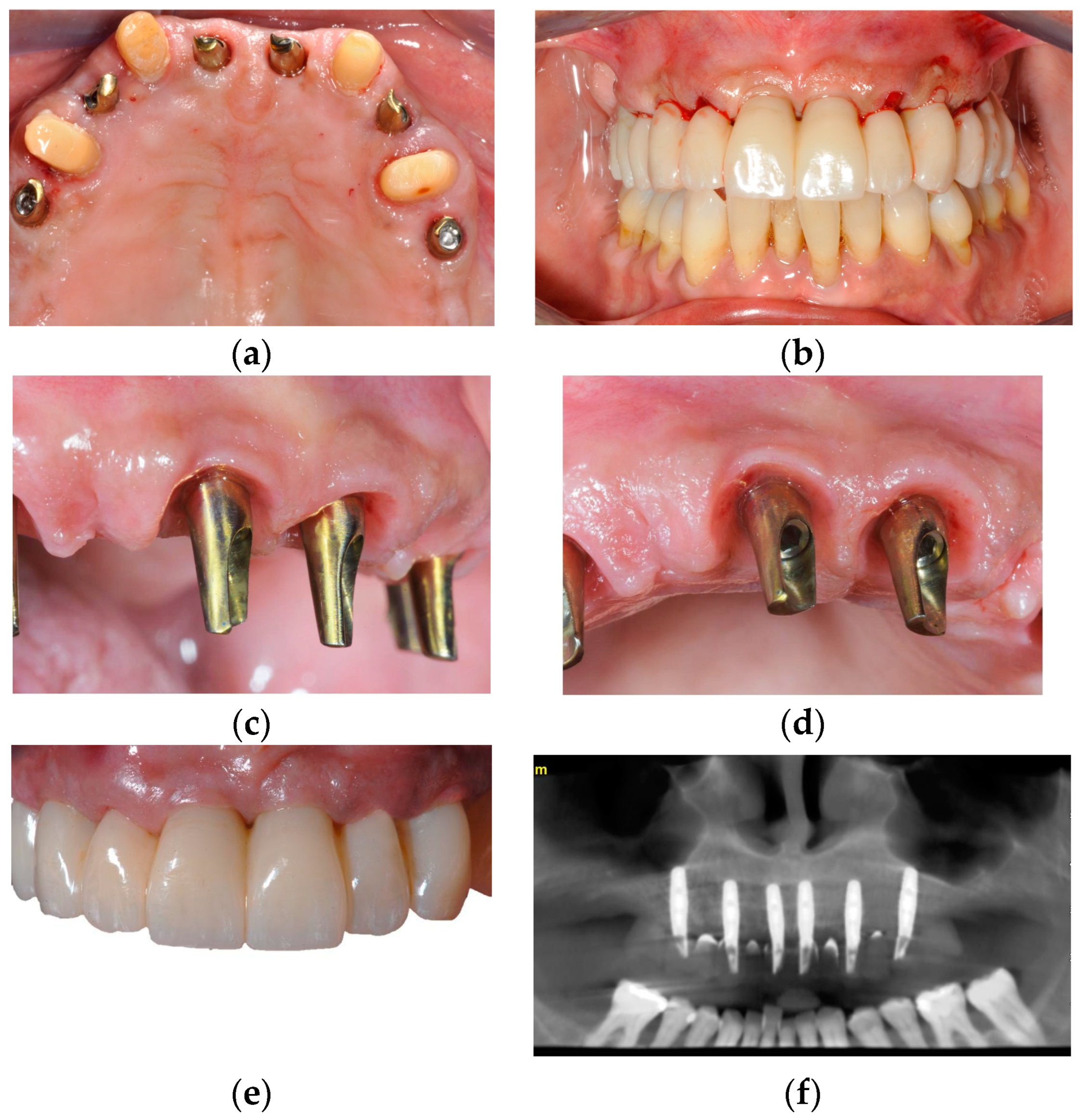Prosthesis 06 00016 g005