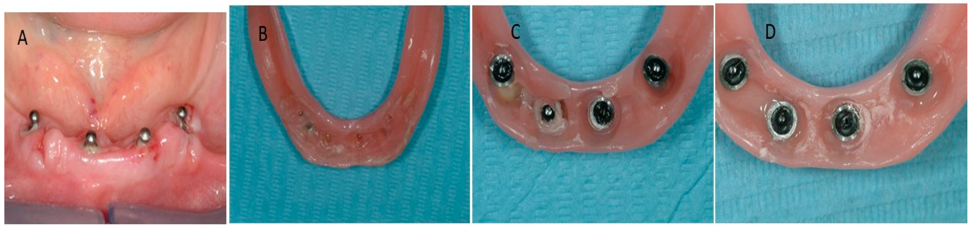 Prosthesis 06 00019 g002