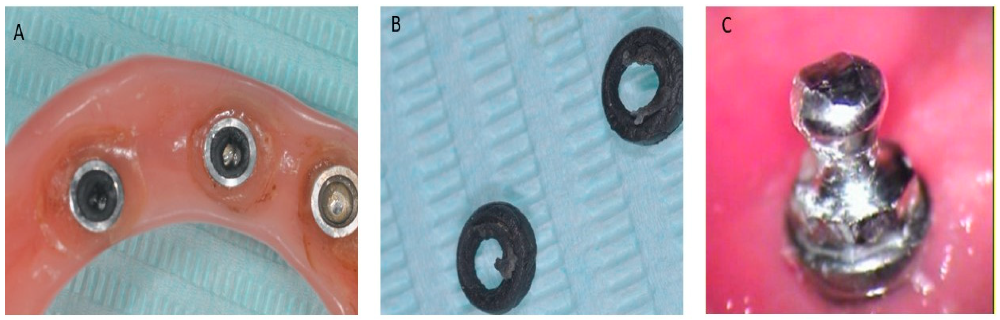 Prosthesis 06 00019 g006