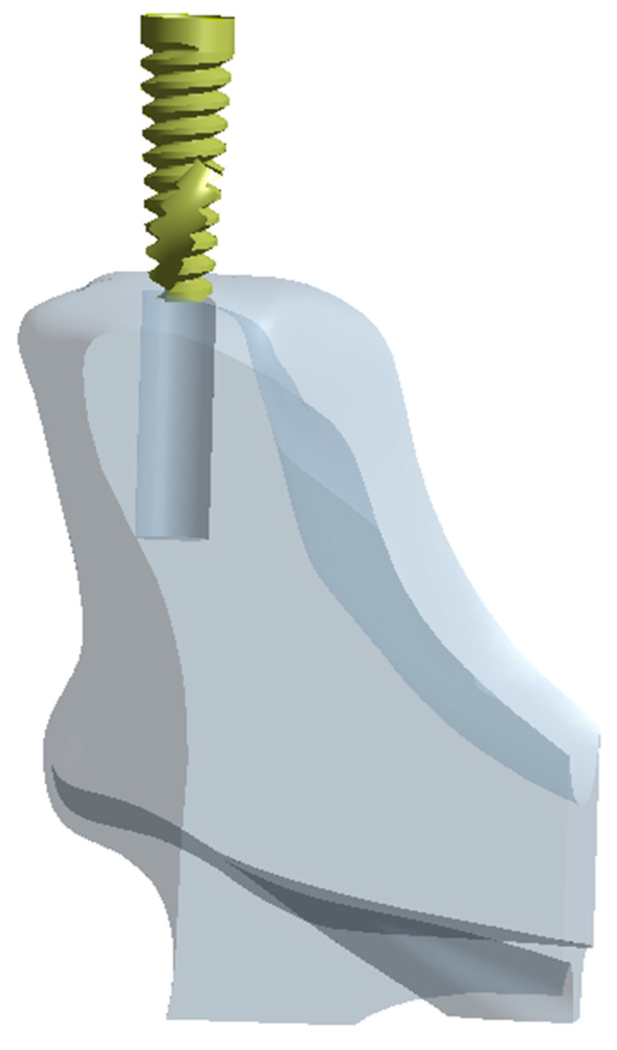 Prosthesis 06 00023 g001