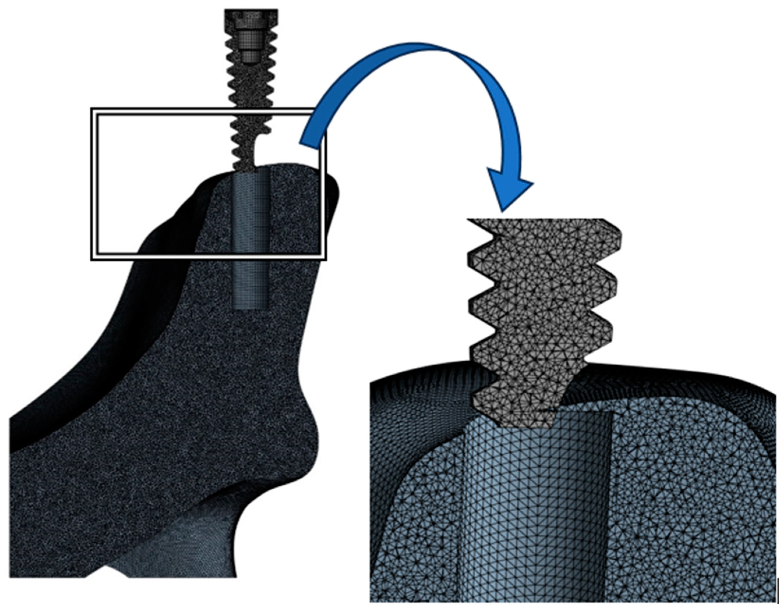 Prosthesis 06 00023 g002