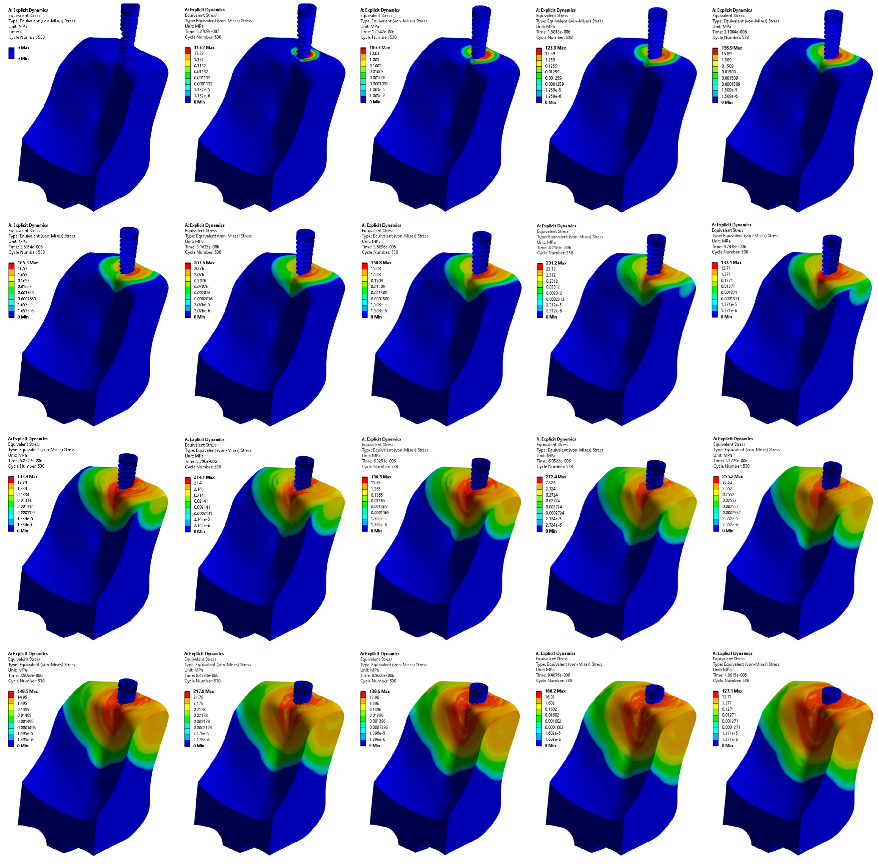 Prosthesis 06 00023 g005