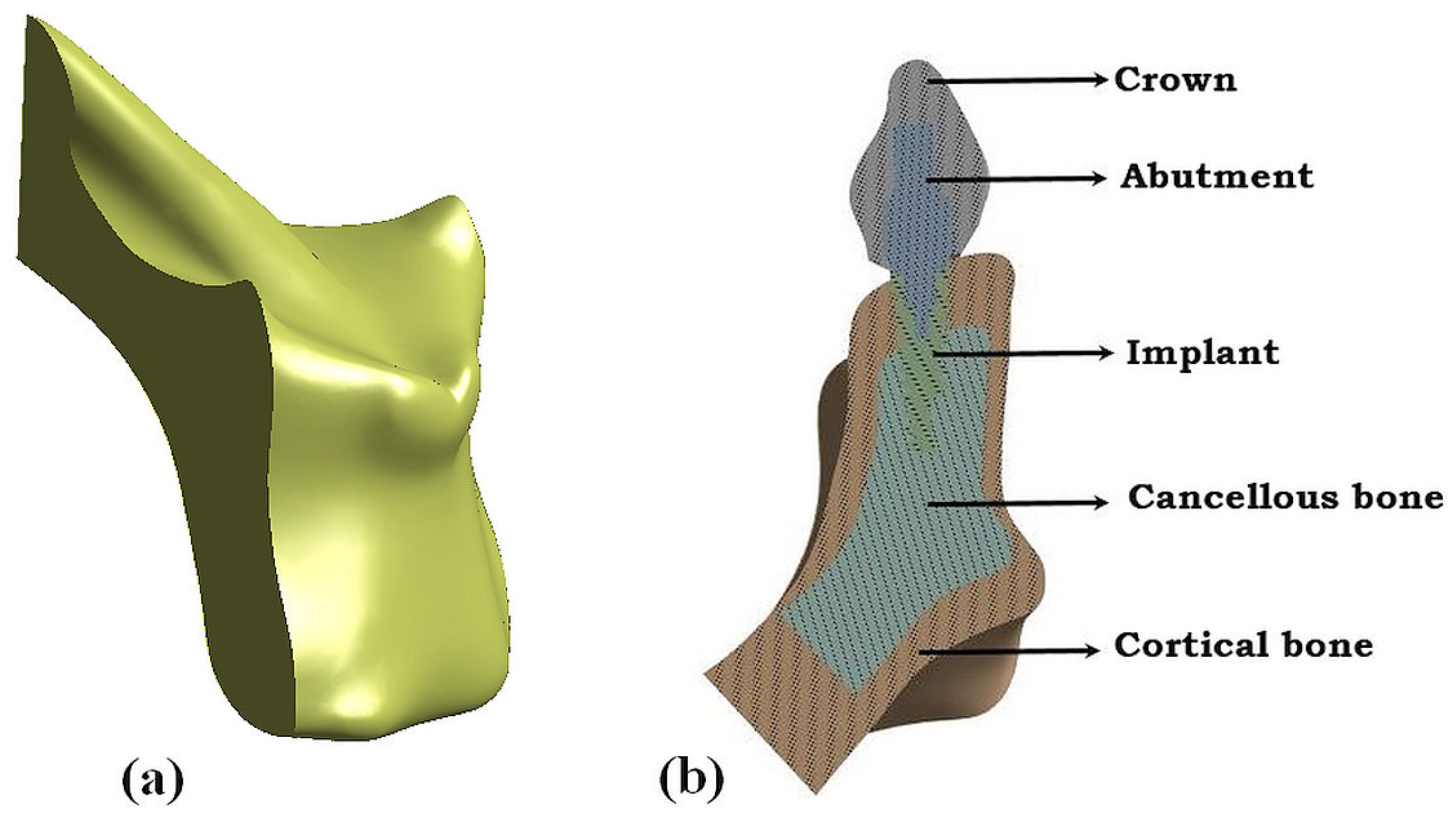 Prosthesis 06 00024 g001