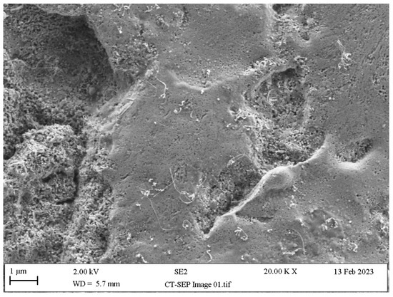 149 Role of DAMPs and cell death in autoimmune diseases: the