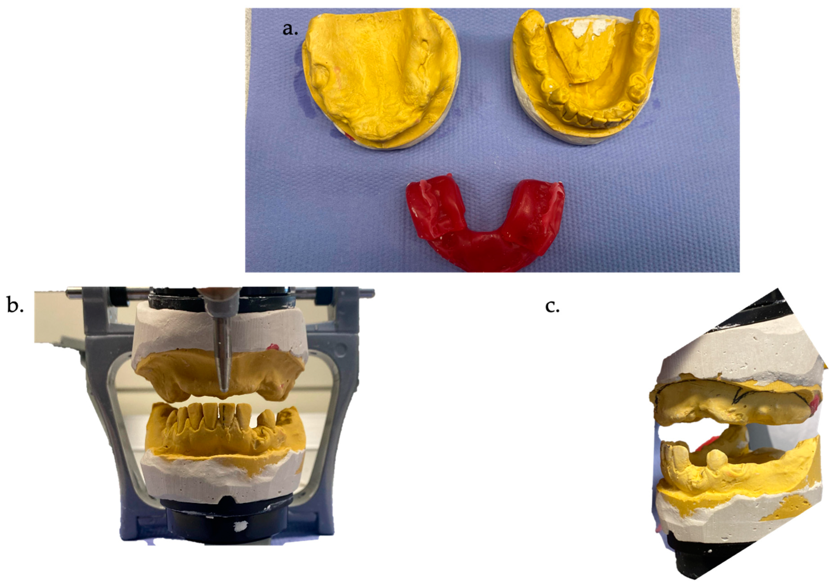 Prosthesis 06 00037 g002
