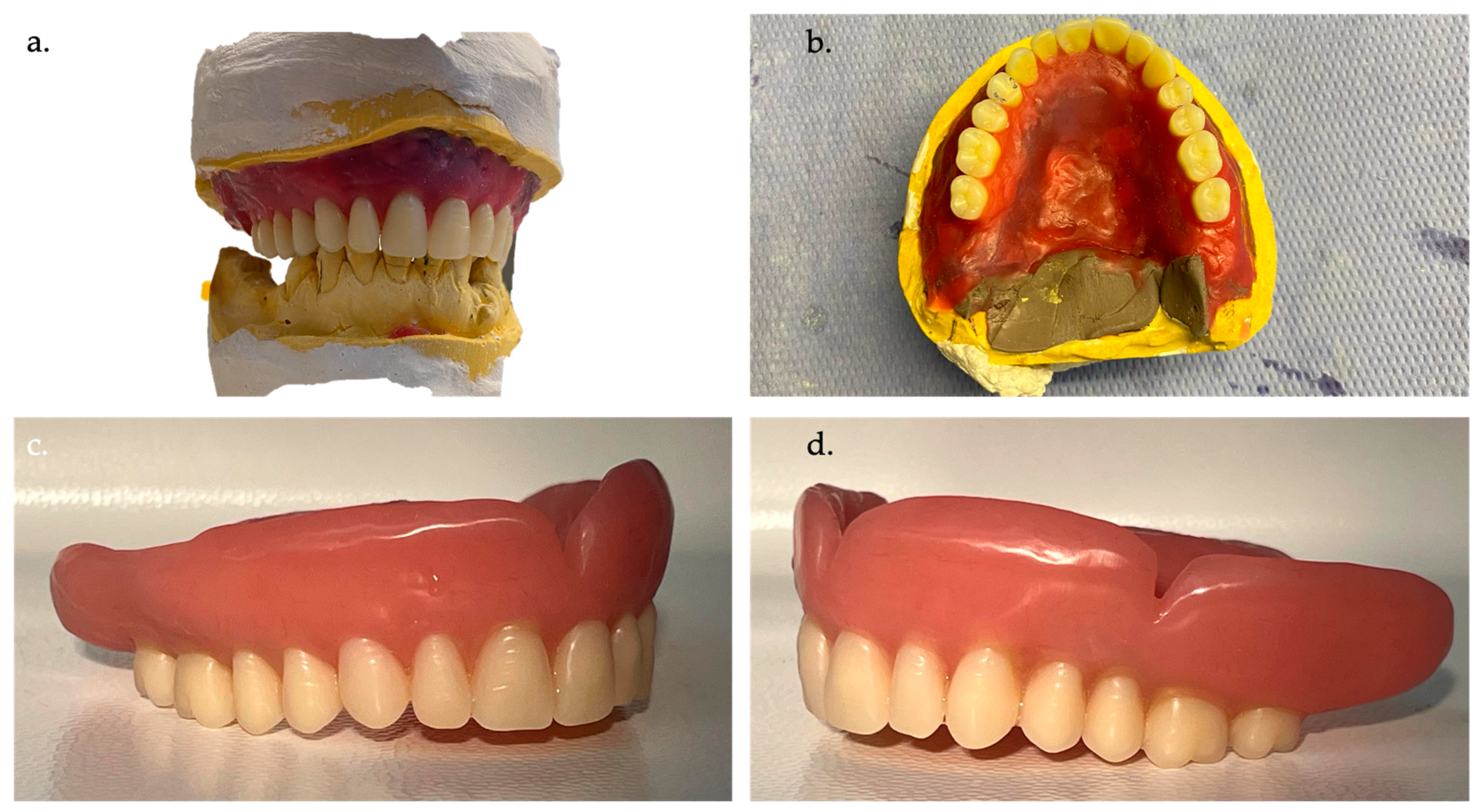Prosthesis 06 00037 g004