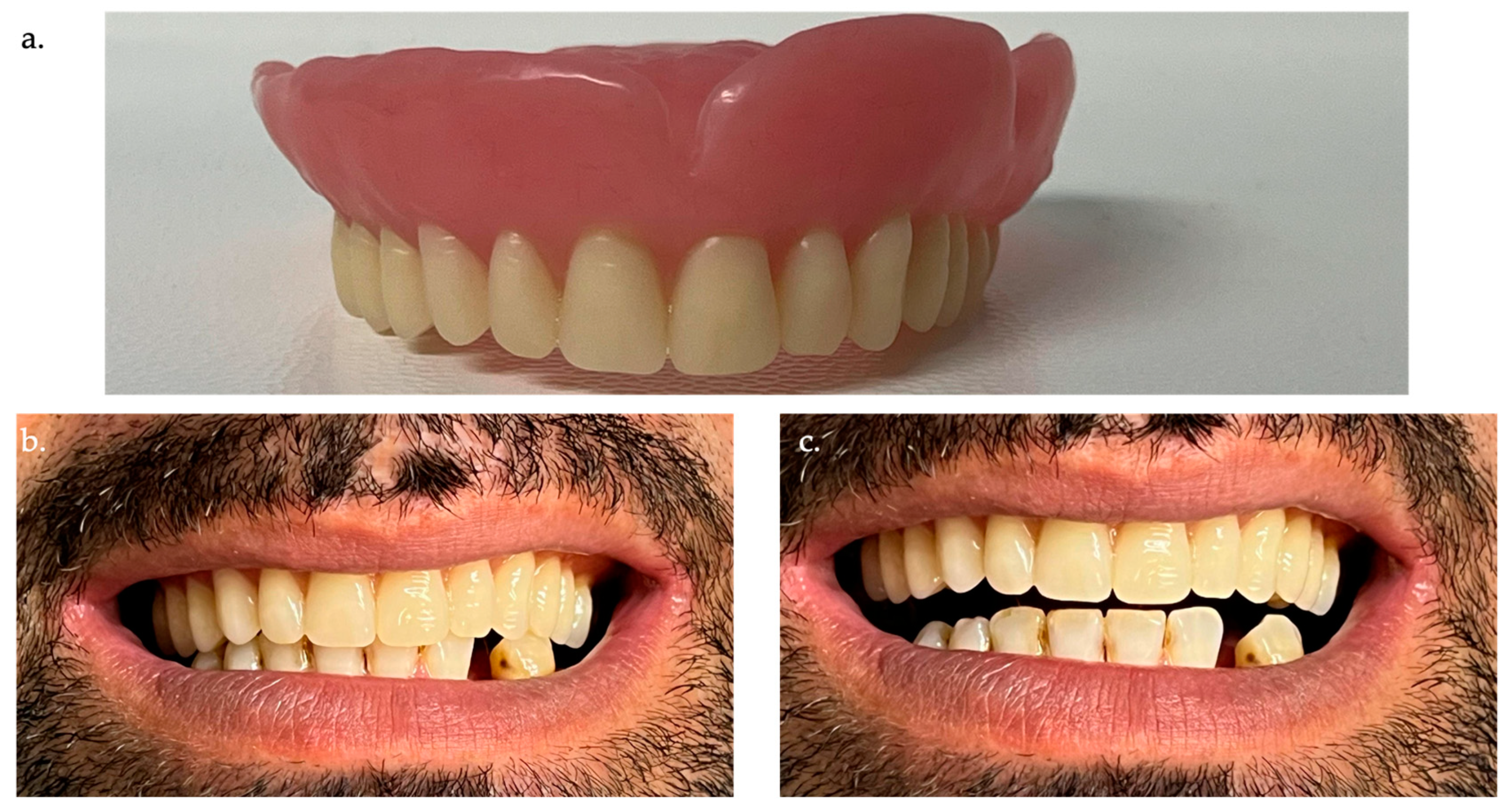 Prosthesis 06 00037 g005