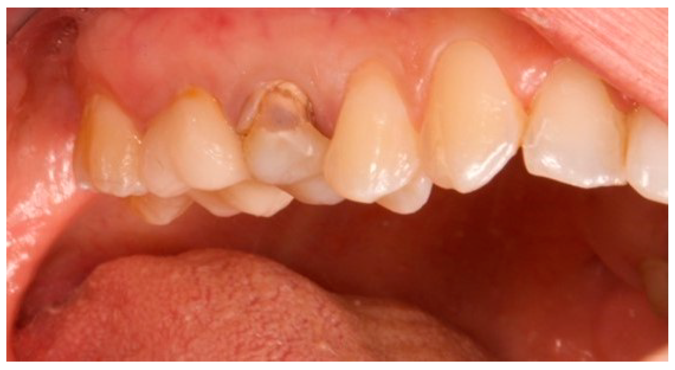 Prosthesis 06 00042 g001