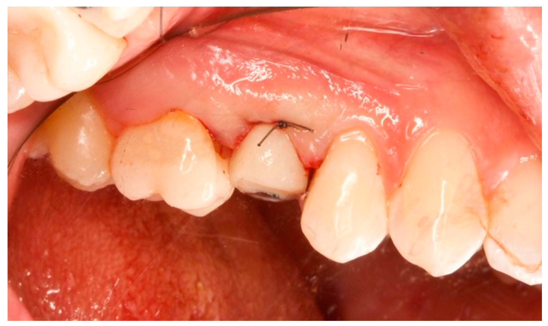 Prosthesis 06 00042 g006