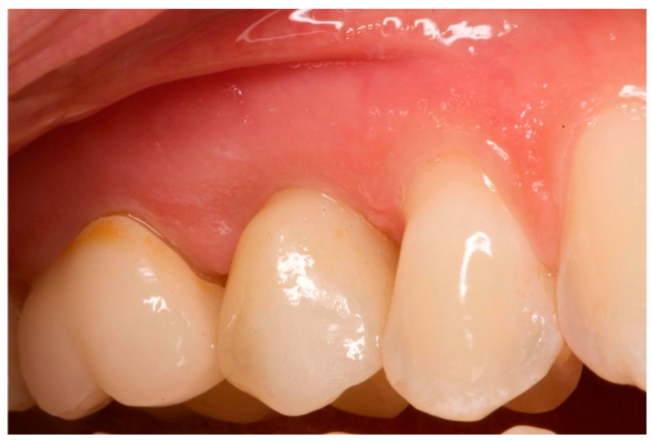 Prosthesis 06 00042 g015