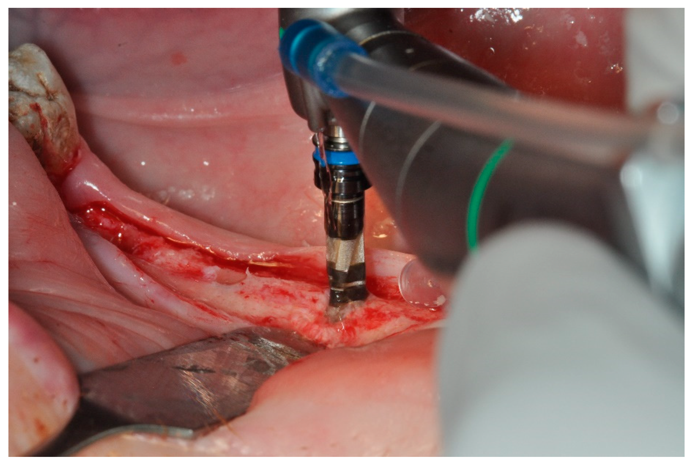 Prosthesis 06 00046 g002