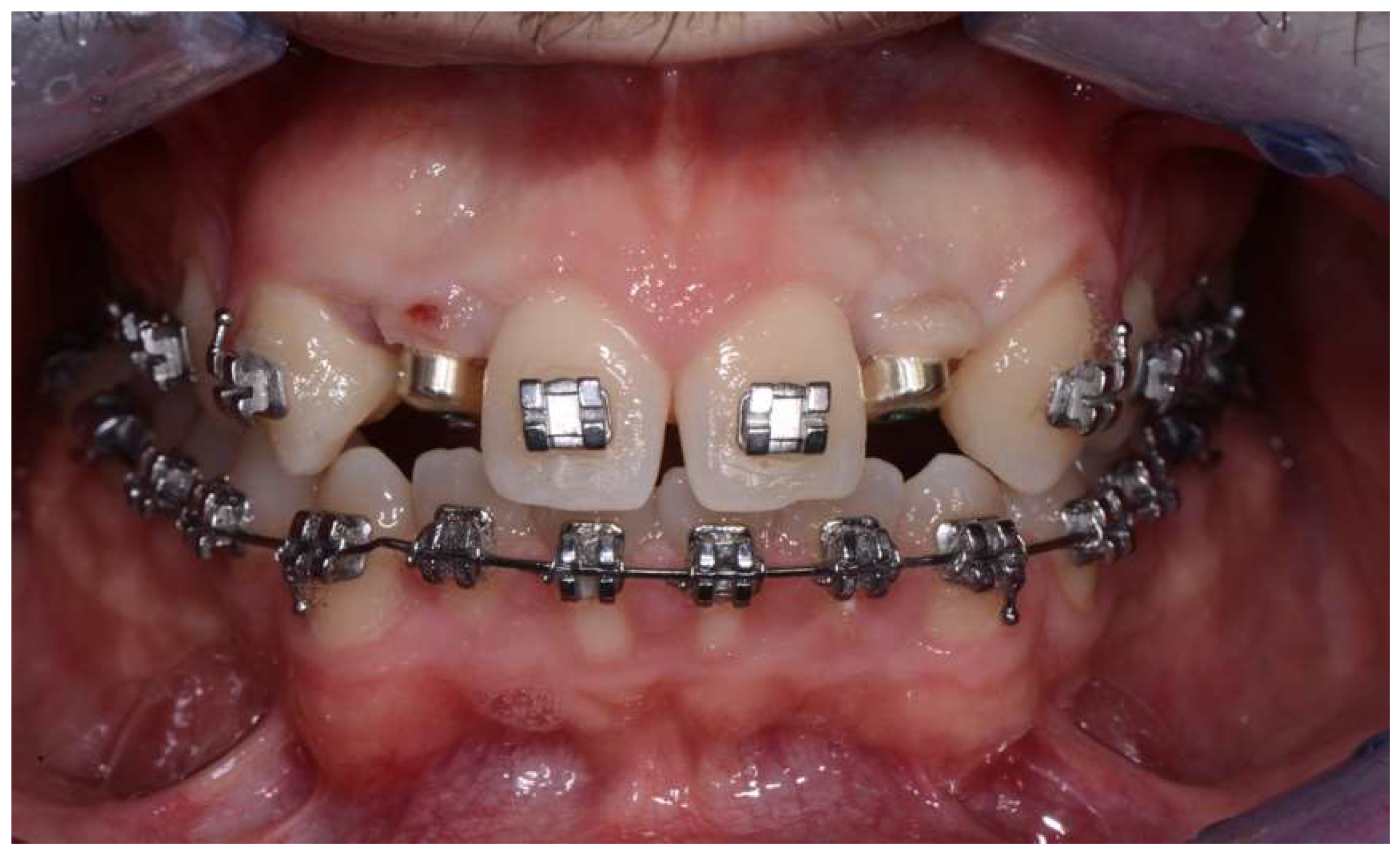 Prosthesis 06 00057 g002 Prosthesis 06 00057 g002