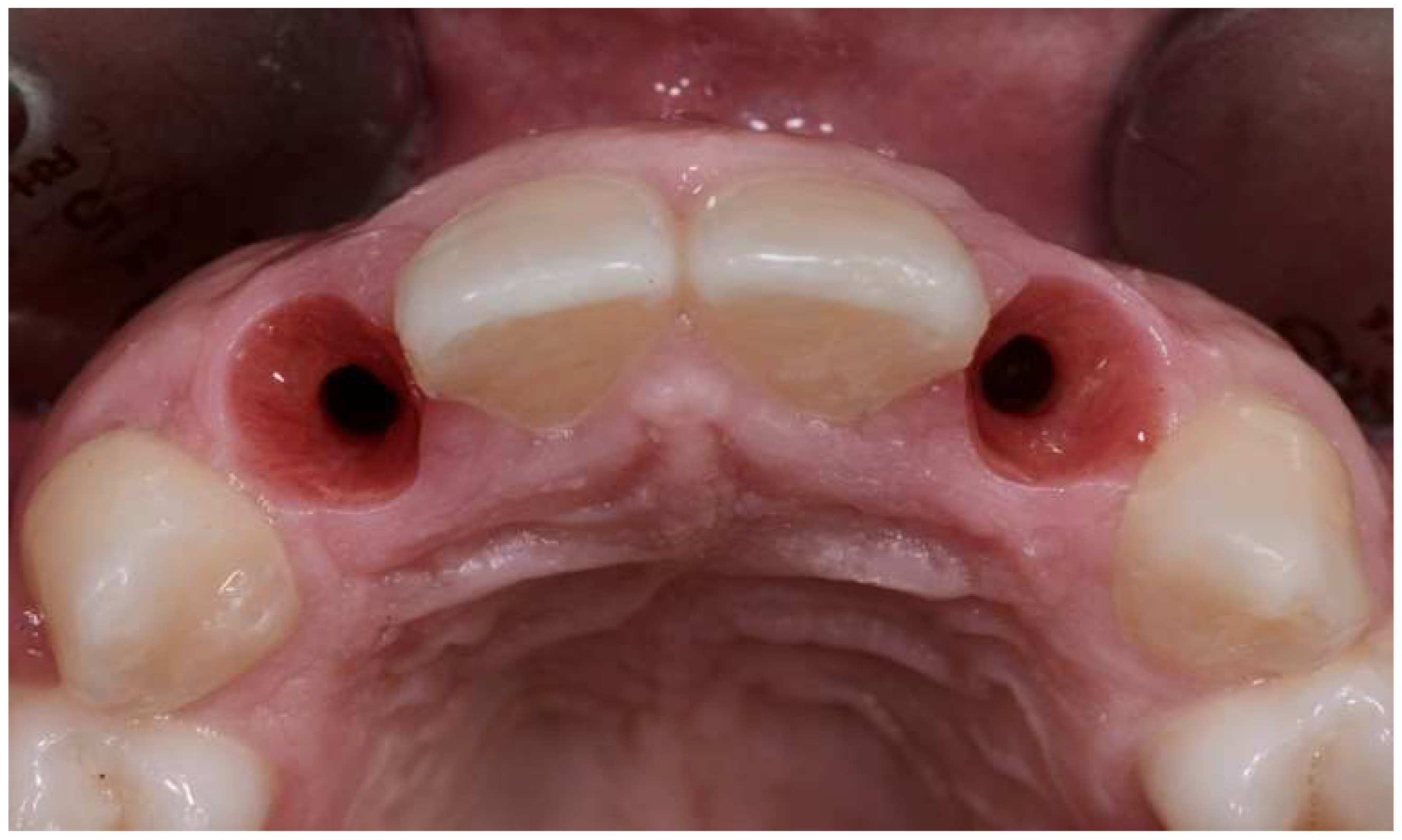 Prosthesis 06 00057 g005 Prosthesis 06 00057 g005